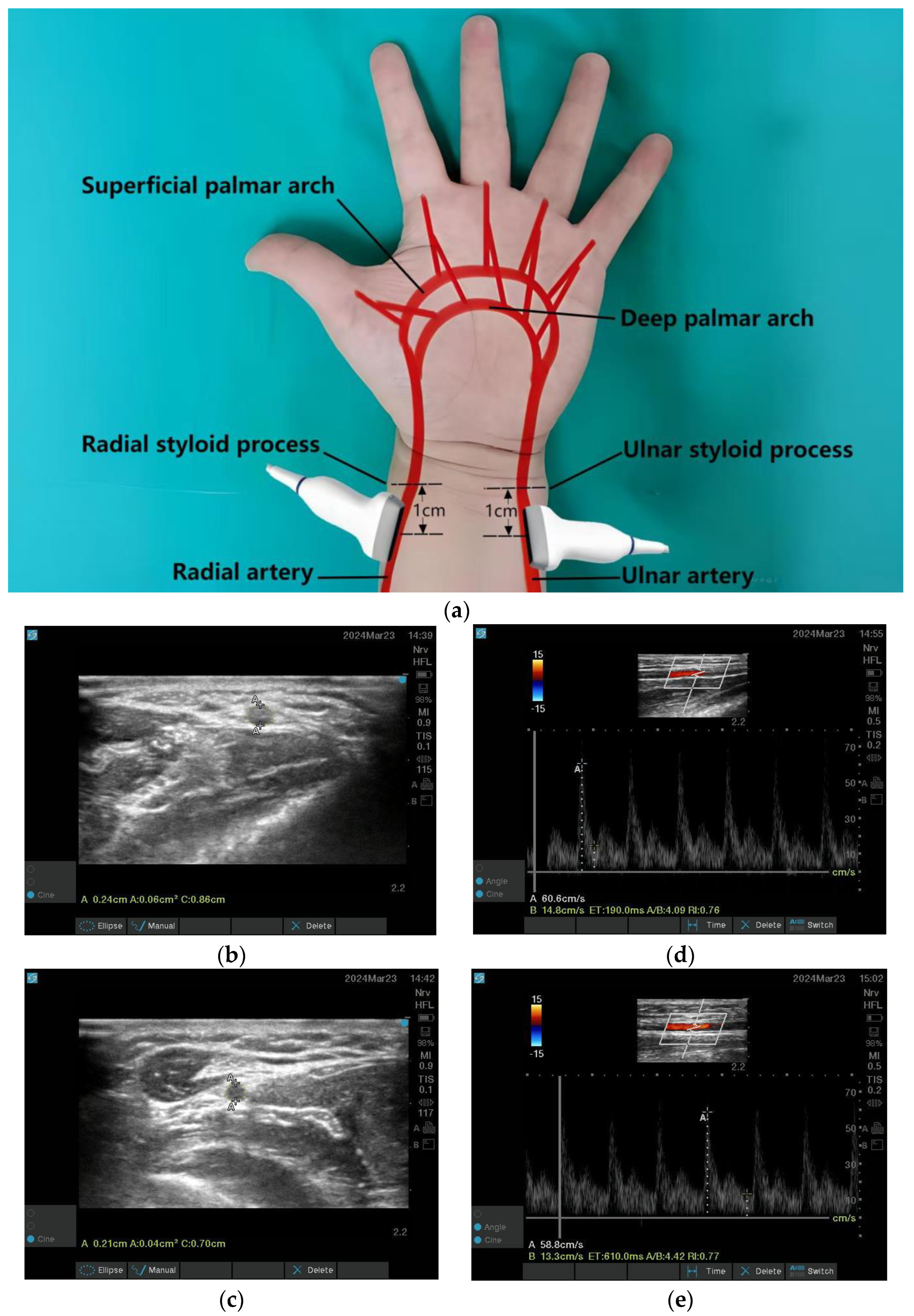 Jcm 14 06591 g003 Jcm 14 06591 g003