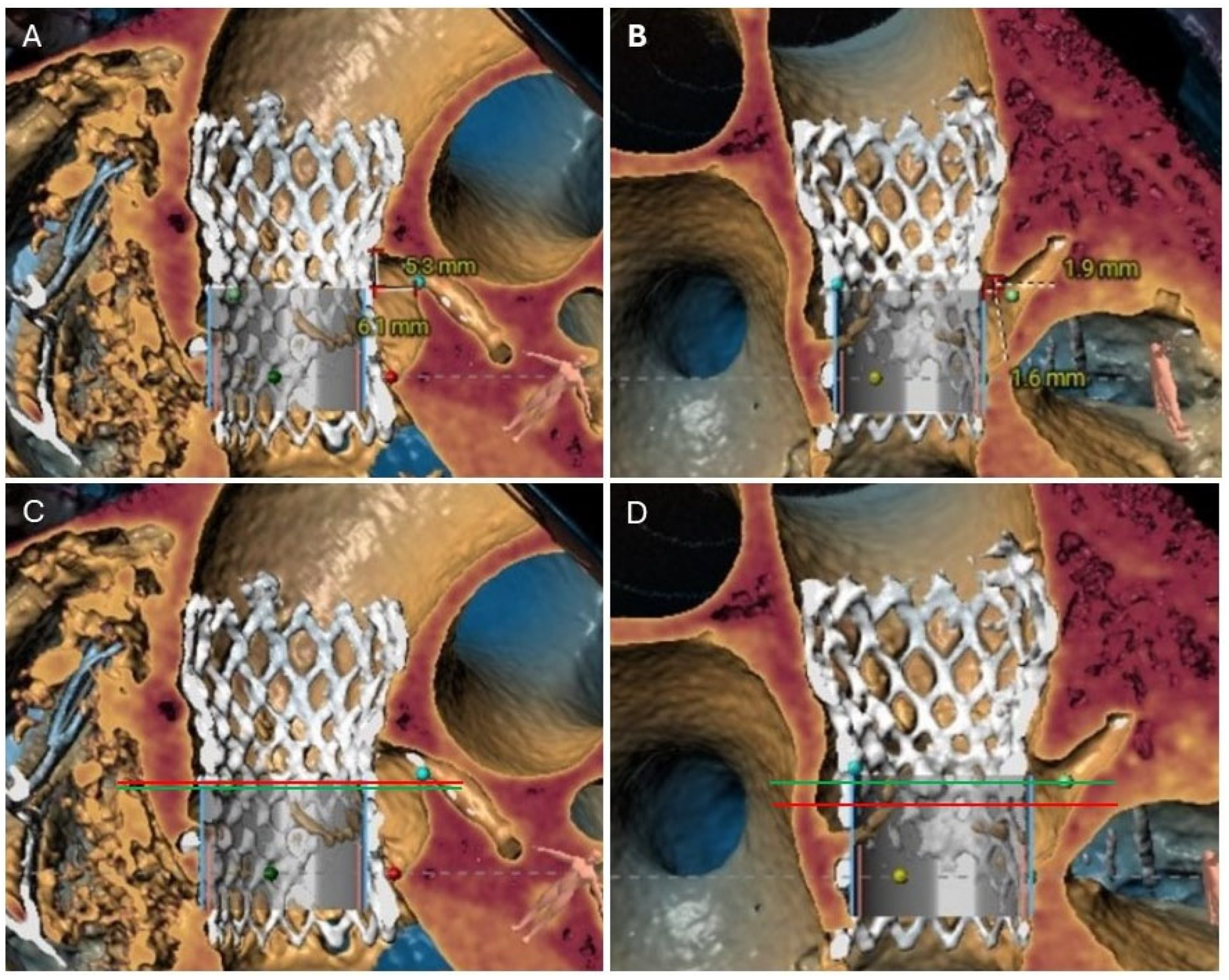 Jcm 14 06608 g002 Jcm 14 06608 g002
