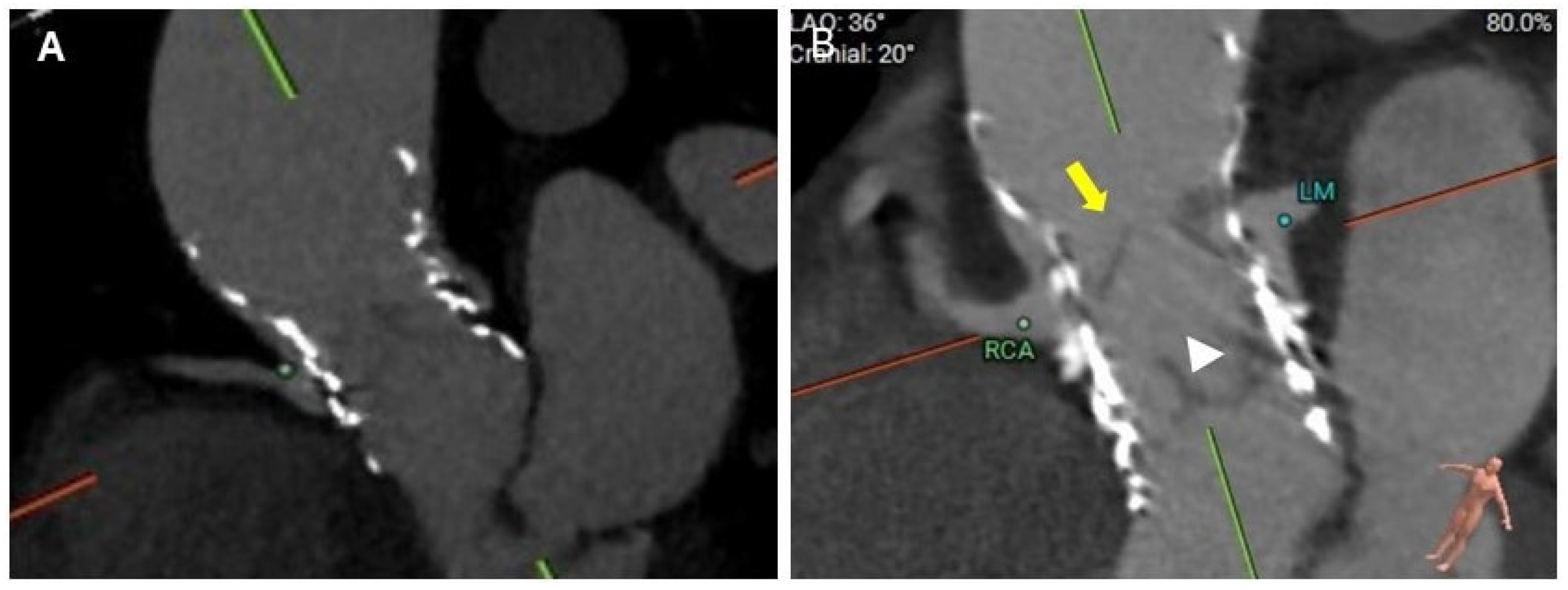 Jcm 14 06608 g004 Jcm 14 06608 g004