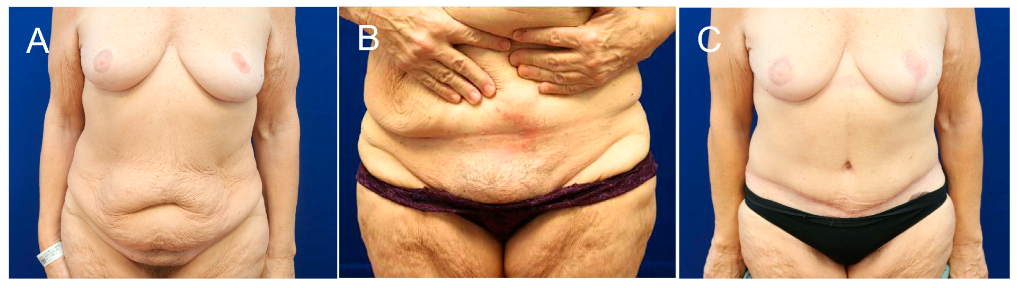 Jcm 14 06617 g002 Jcm 14 06617 g002