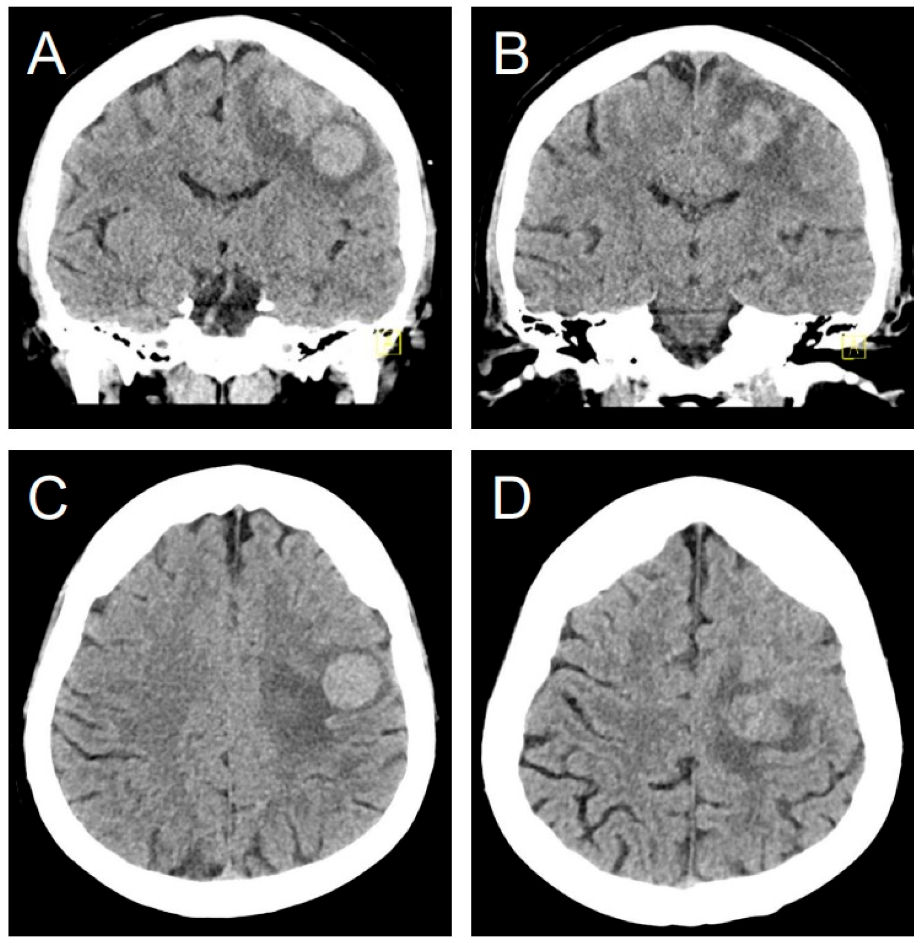 Jcm 14 06631 g003 Jcm 14 06631 g003