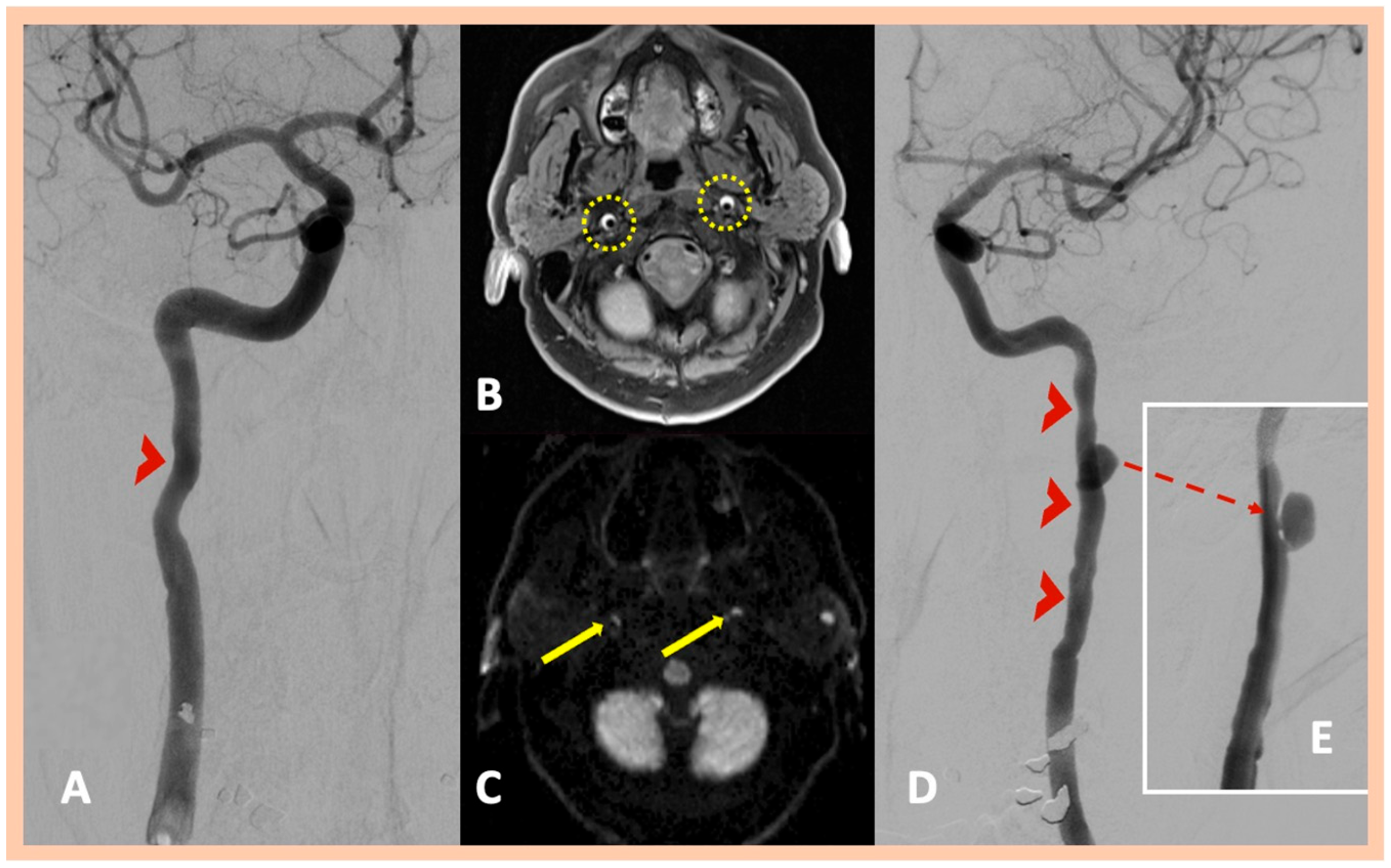 Jcm 14 06635 g003 Jcm 14 06635 g003