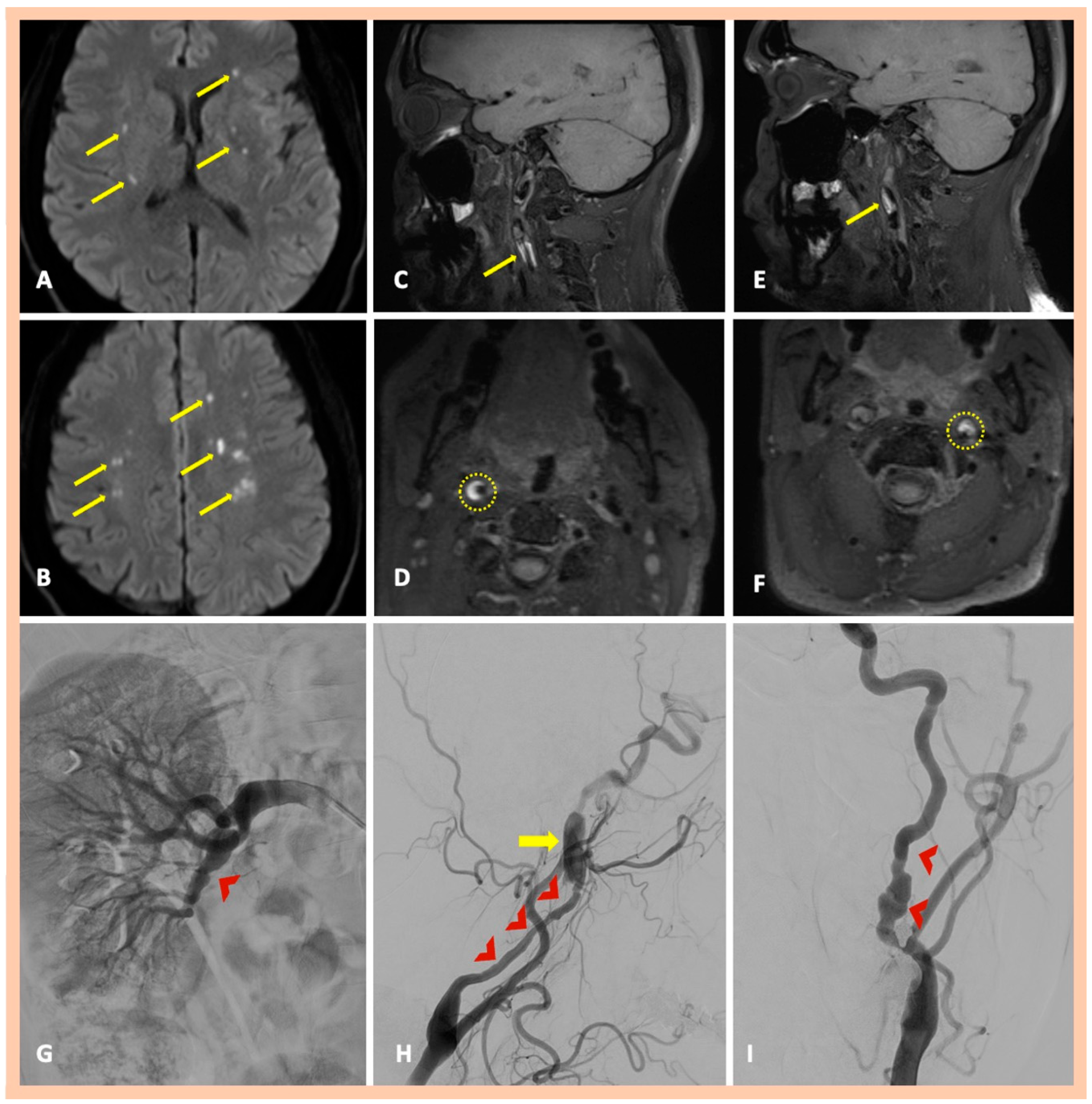 Jcm 14 06635 g004 Jcm 14 06635 g004