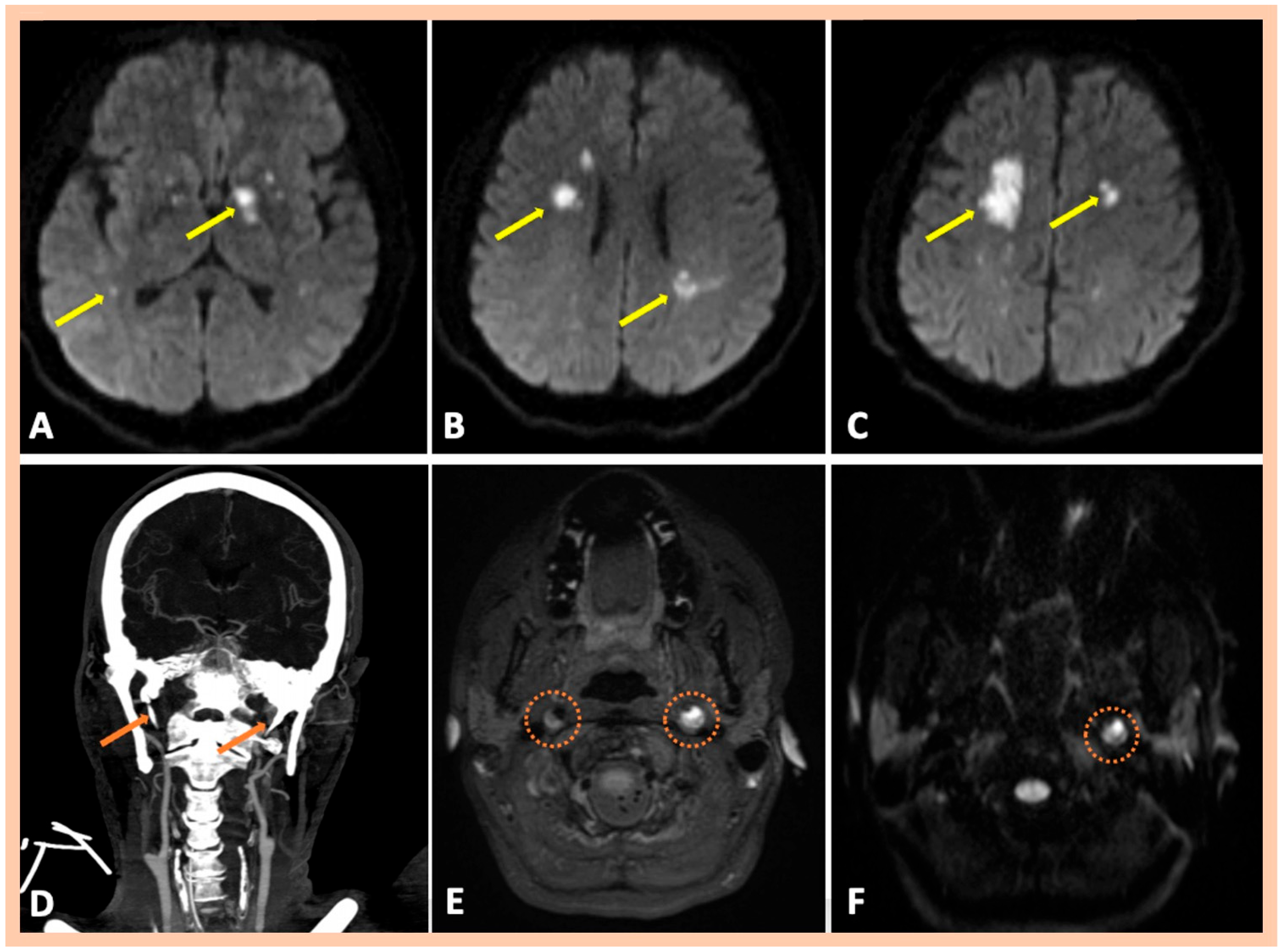Jcm 14 06635 g005 Jcm 14 06635 g005