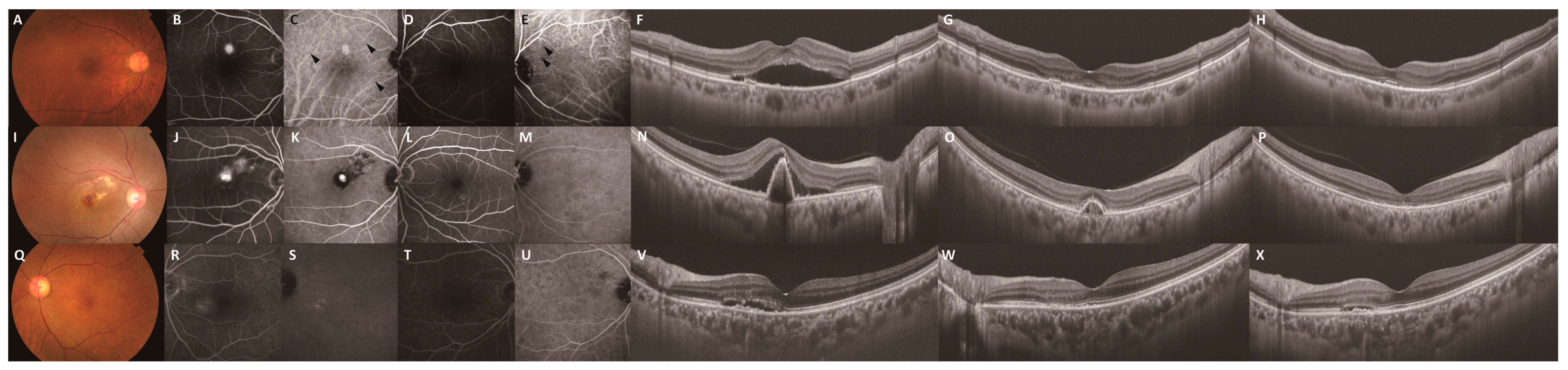 Jcm 14 06637 g005 Jcm 14 06637 g005