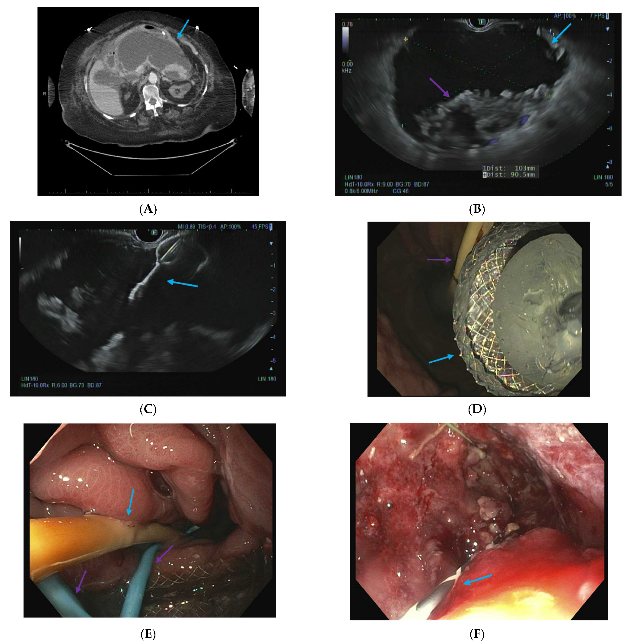 Jcm 14 06683 sch003a