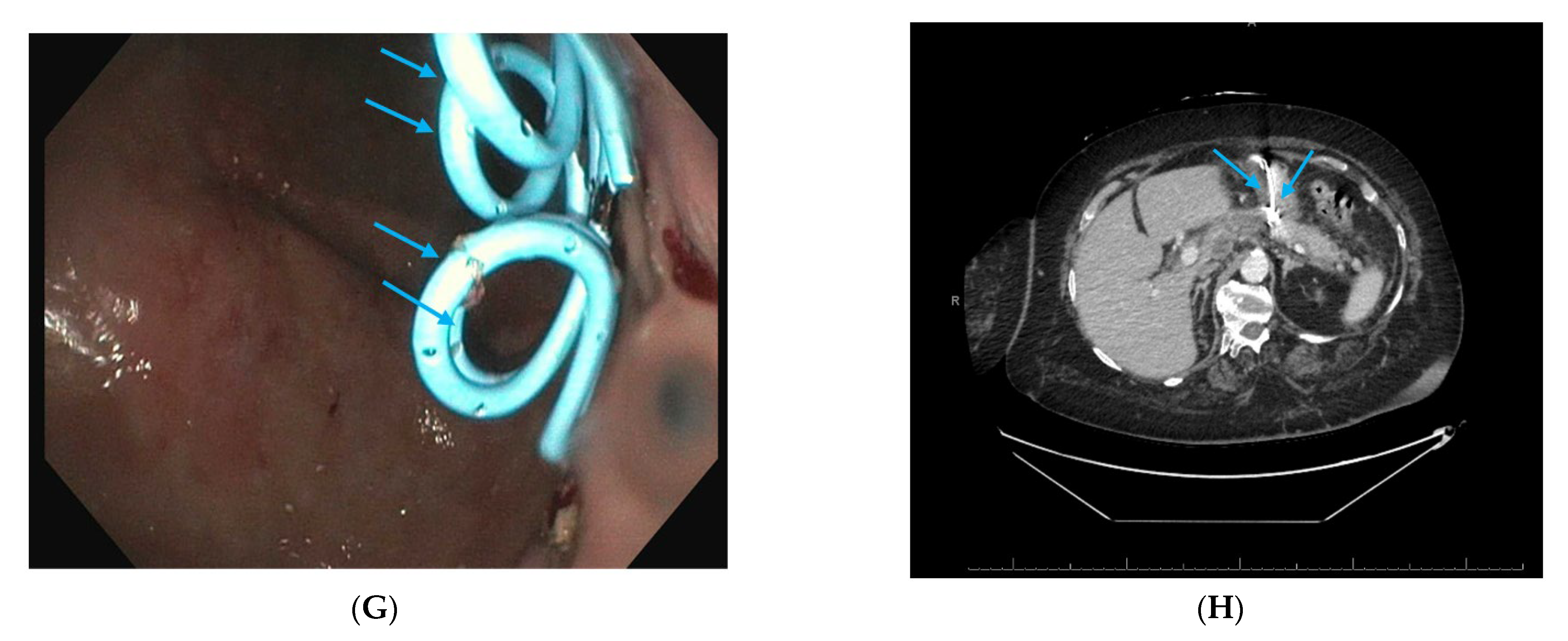 Jcm 14 06683 sch003b