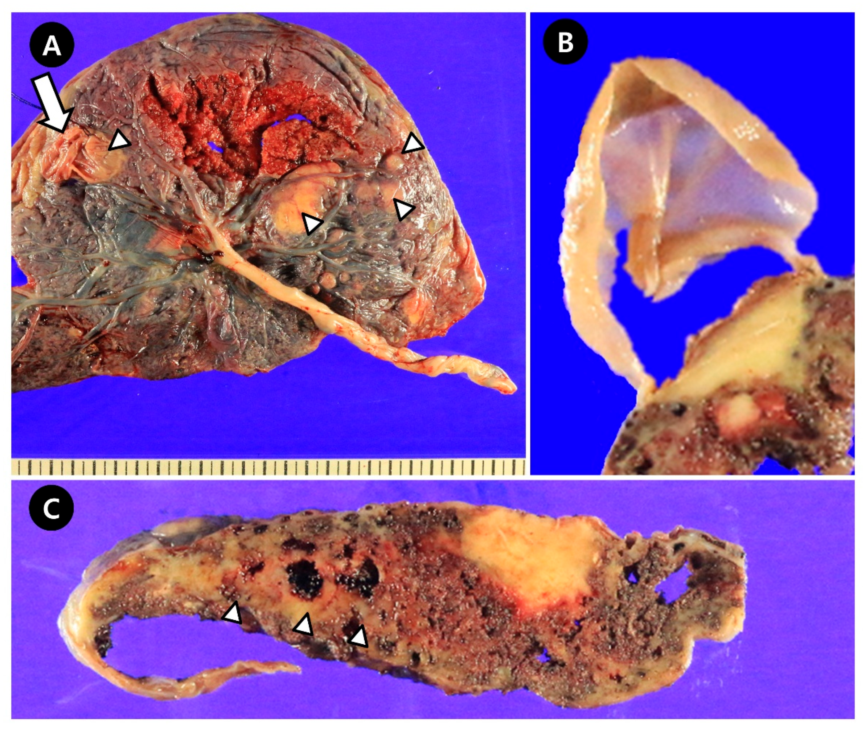 Jcm 14 06698 g002 Jcm 14 06698 g002