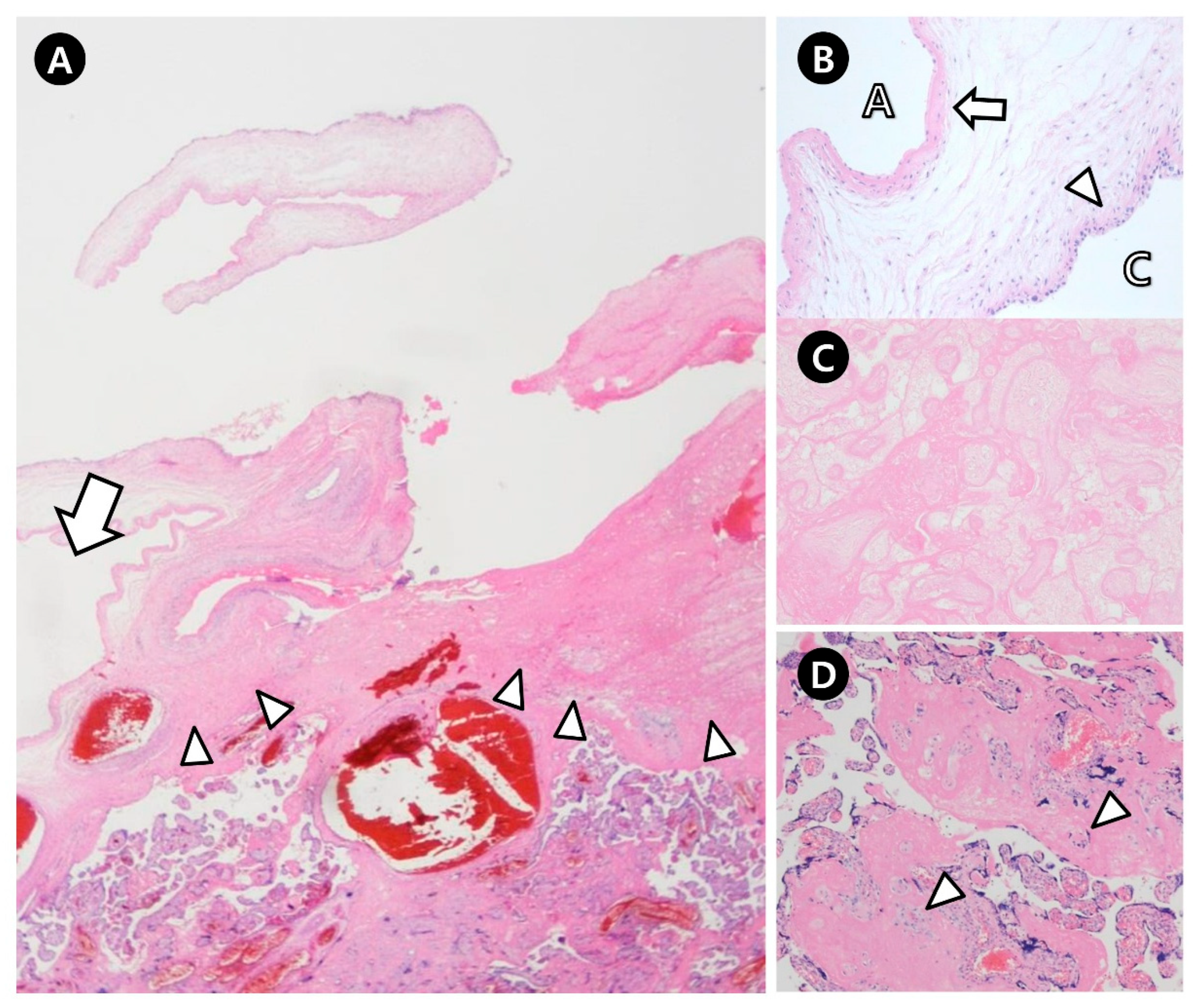 Jcm 14 06698 g003 Jcm 14 06698 g003