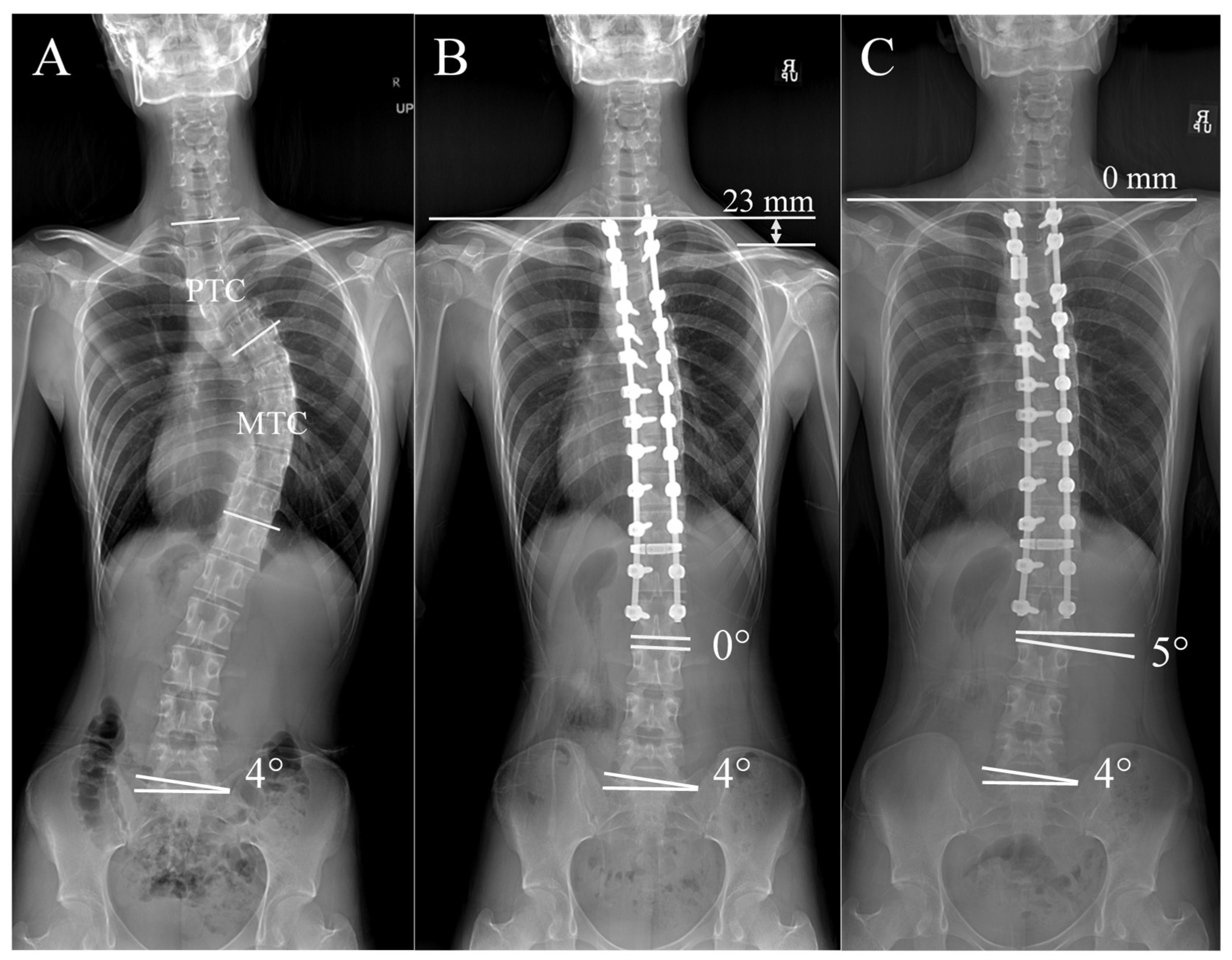 Jcm 14 06850 g004 Jcm 14 06850 g004