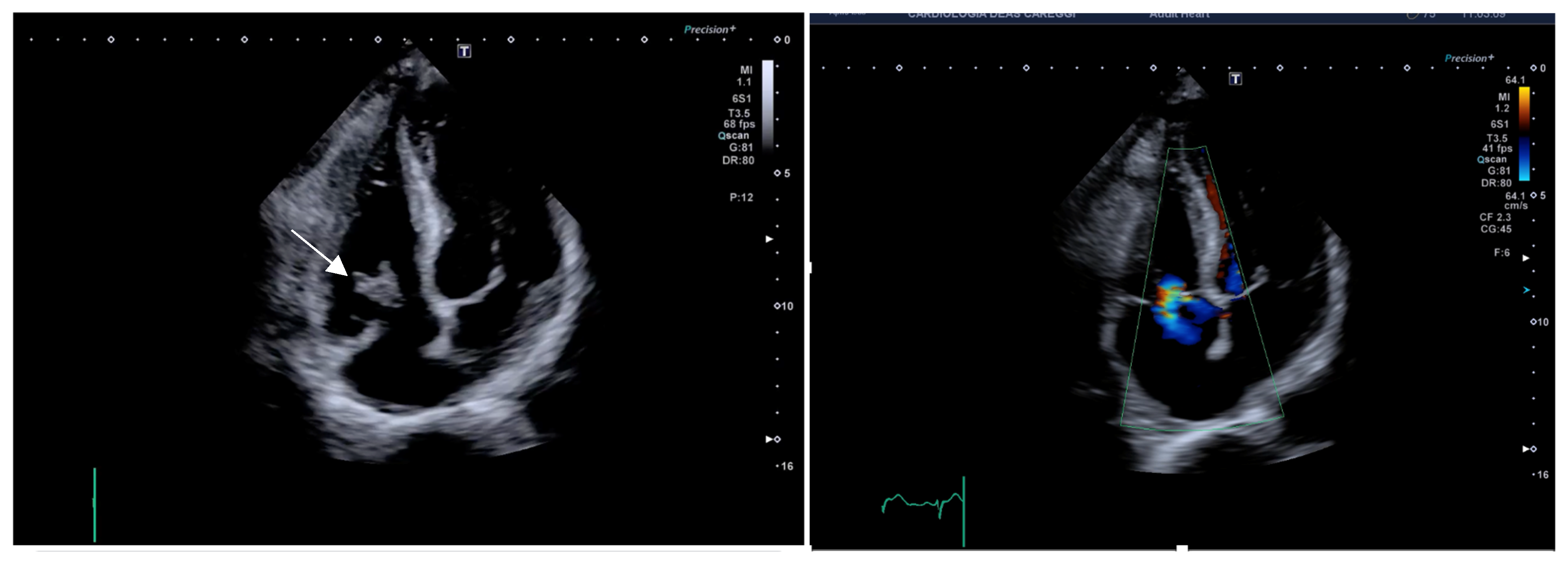 Jcm 14 06878 g003 Jcm 14 06878 g003