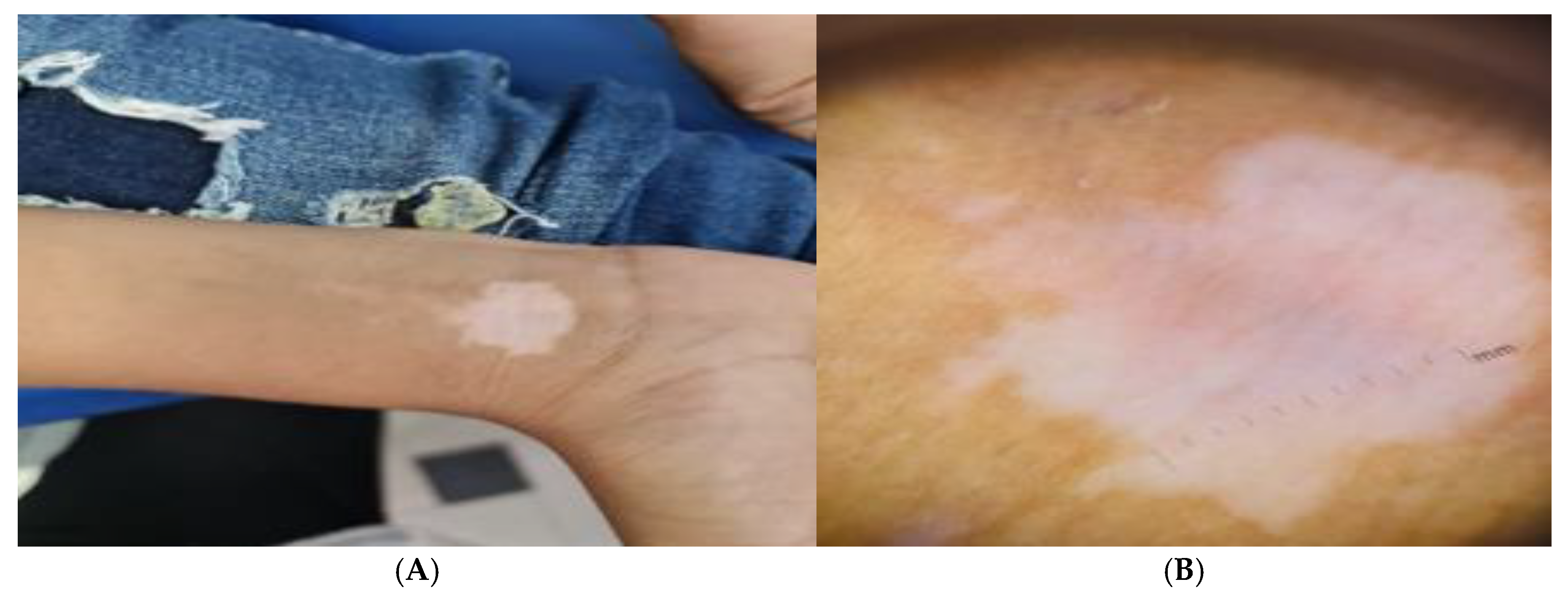 Jcm 14 06894 g001 Jcm 14 06894 g001