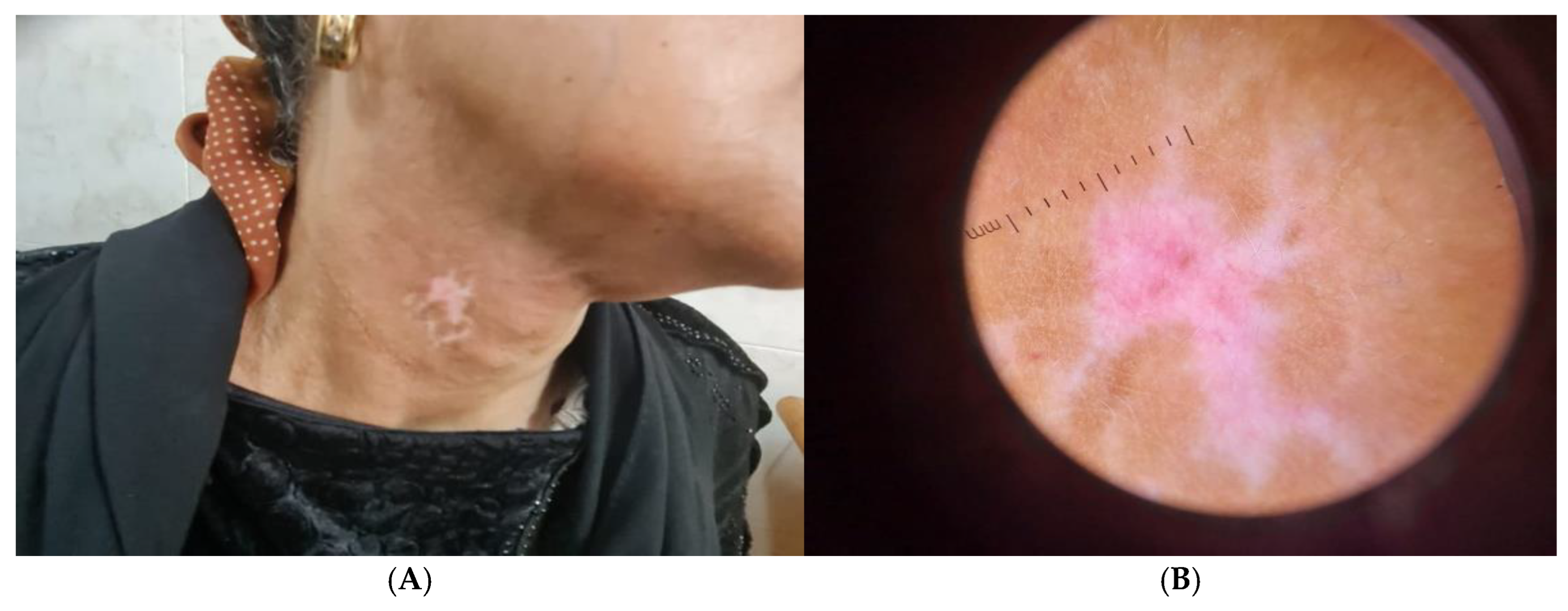 Jcm 14 06894 g003 Jcm 14 06894 g003