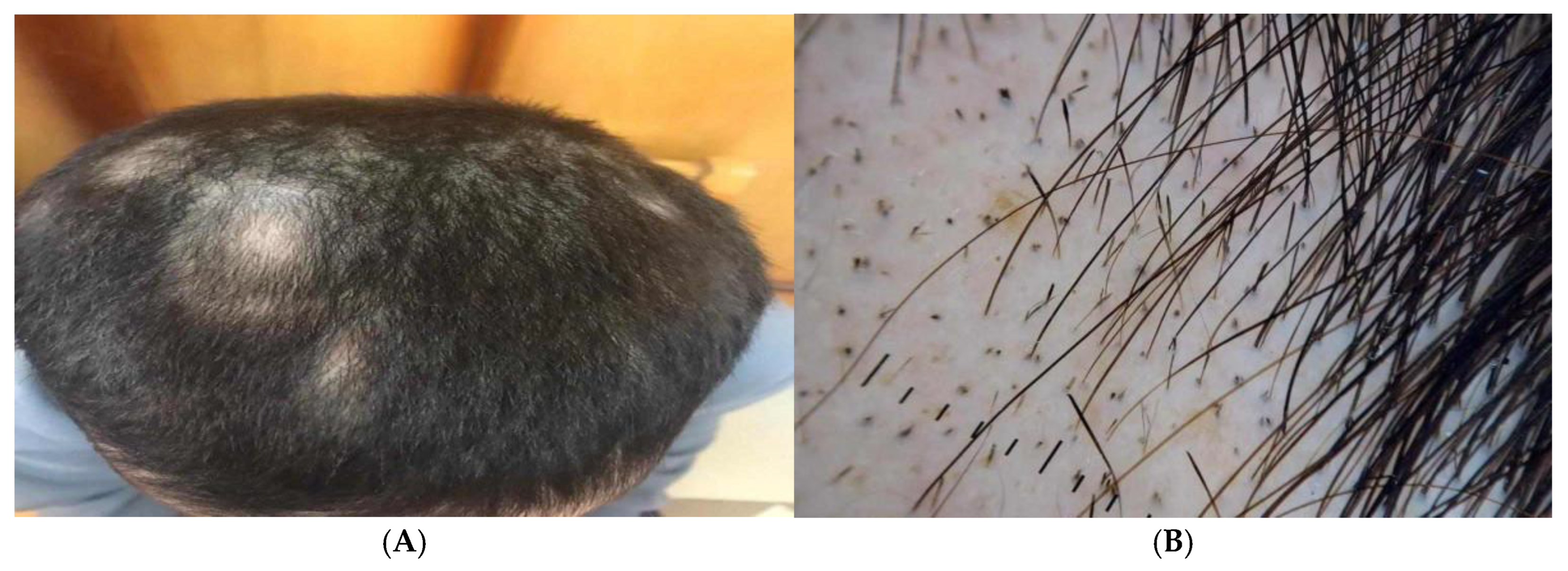 Jcm 14 06894 g004 Jcm 14 06894 g004