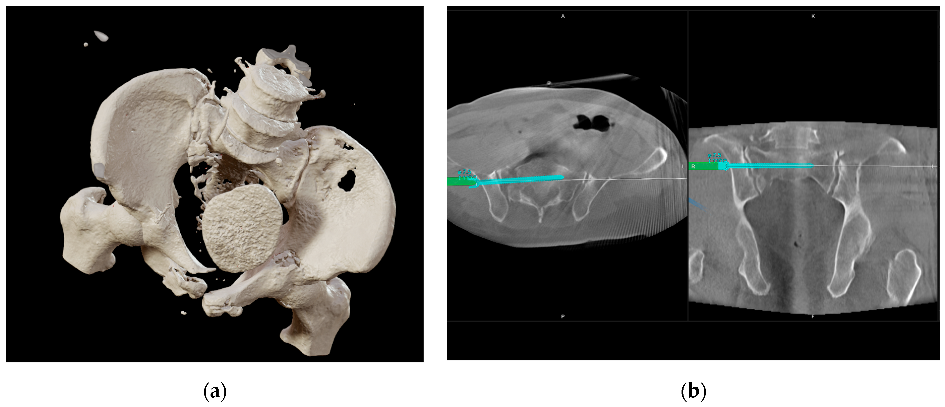 Jcm 14 06920 g001 Jcm 14 06920 g001