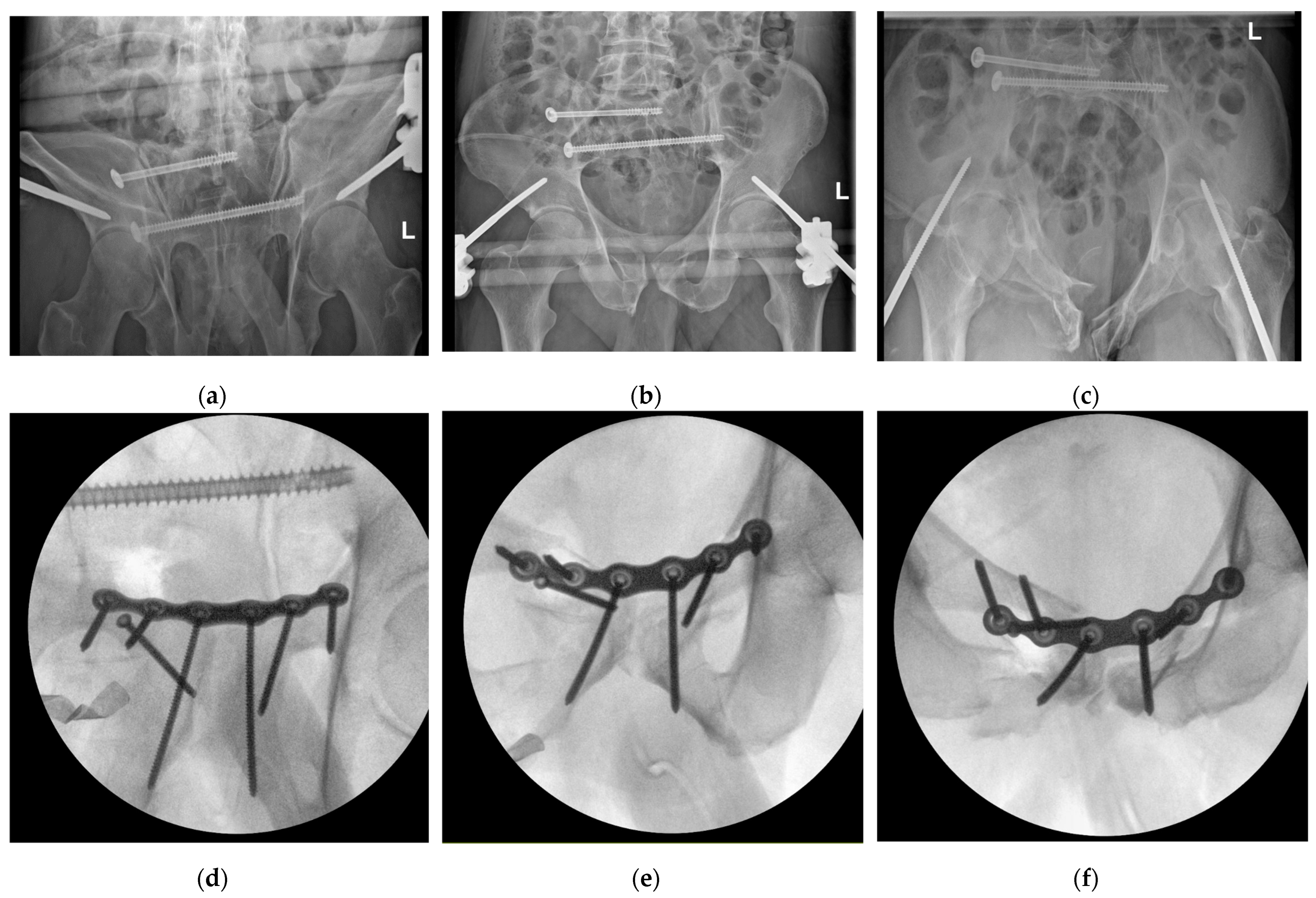 Jcm 14 06920 g005 Jcm 14 06920 g005