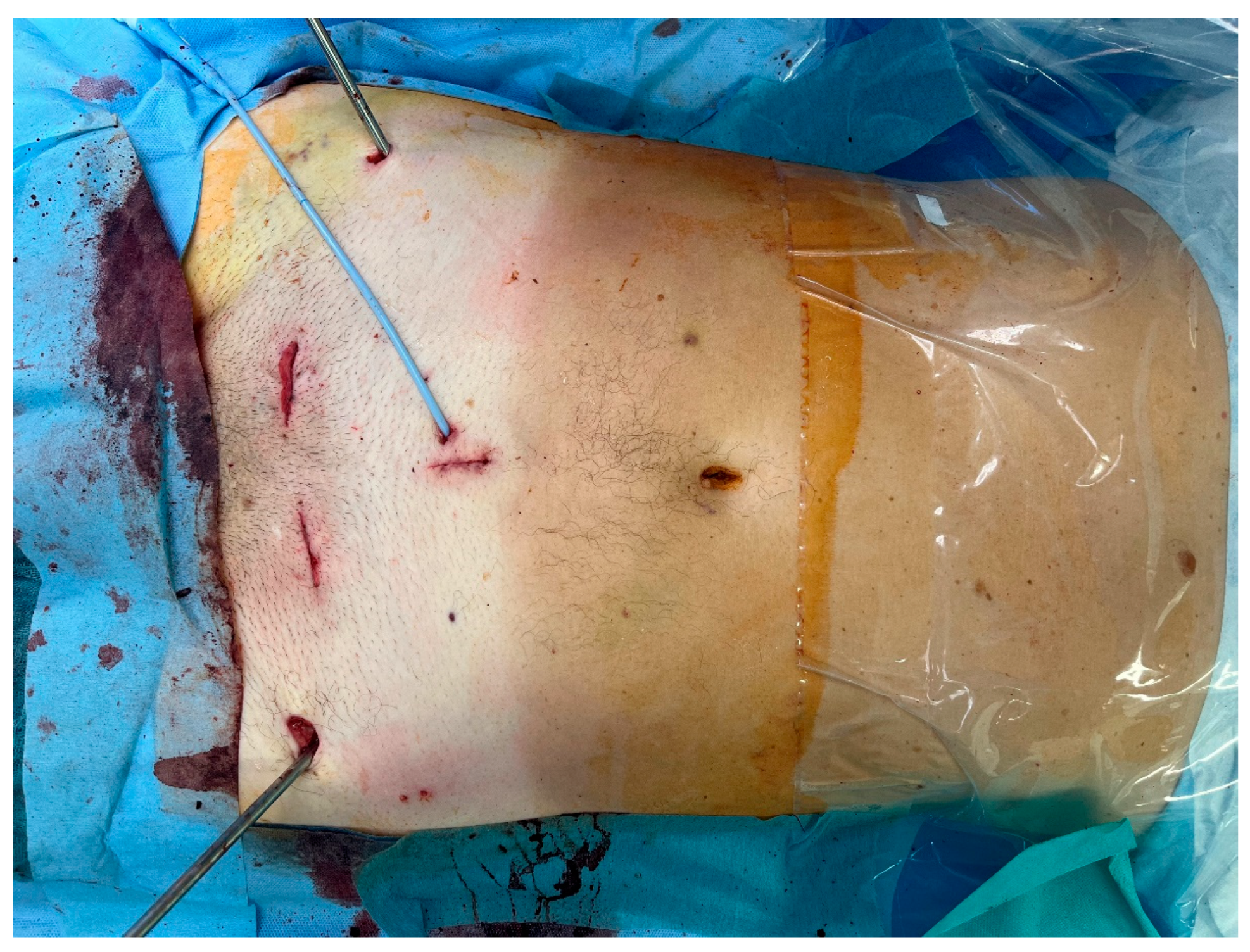 Jcm 14 06920 g006 Jcm 14 06920 g006