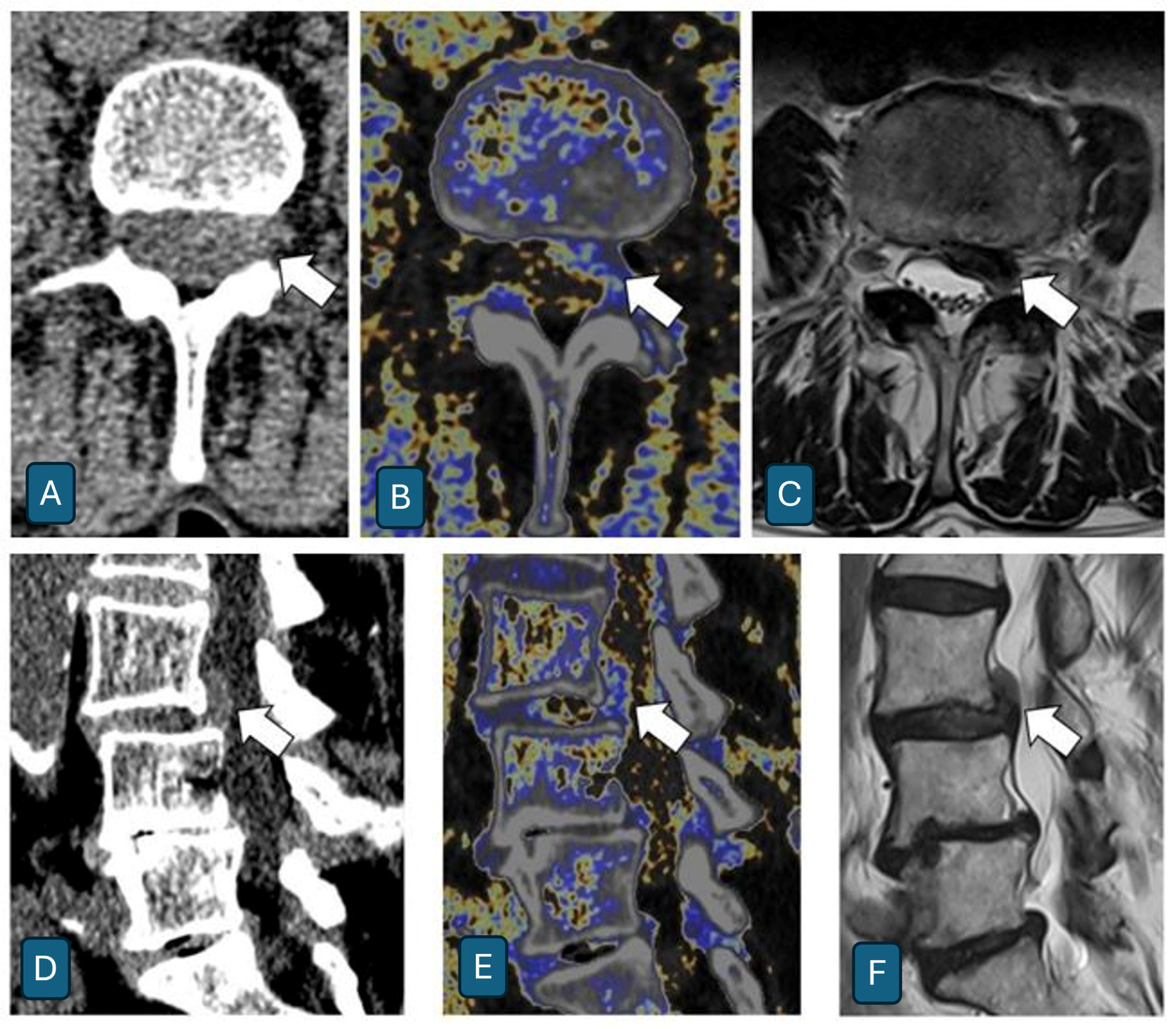 Jcm 14 07000 g007 Jcm 14 07000 g007