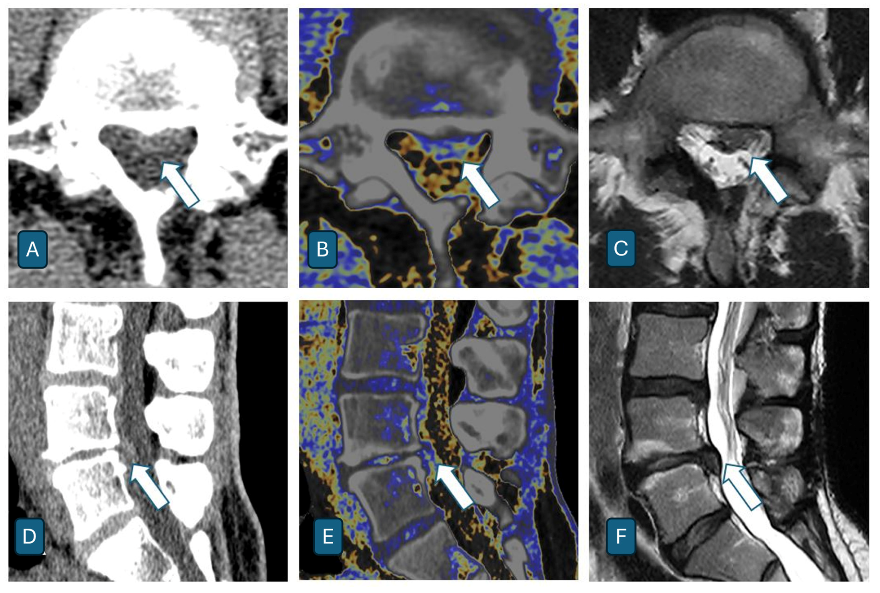 Jcm 14 07000 g008 Jcm 14 07000 g008