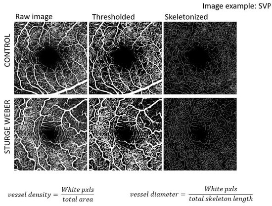 oct様 Τowardpi BMIZAR – 400KHz Full Range SS-OCTA - OptoHellas