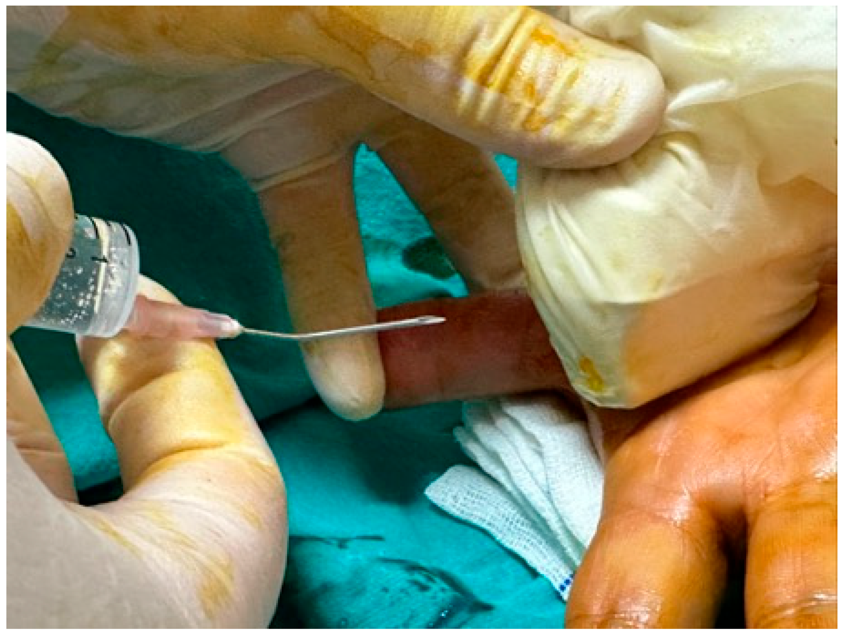 Jcm 14 07064 g001 Jcm 14 07064 g001