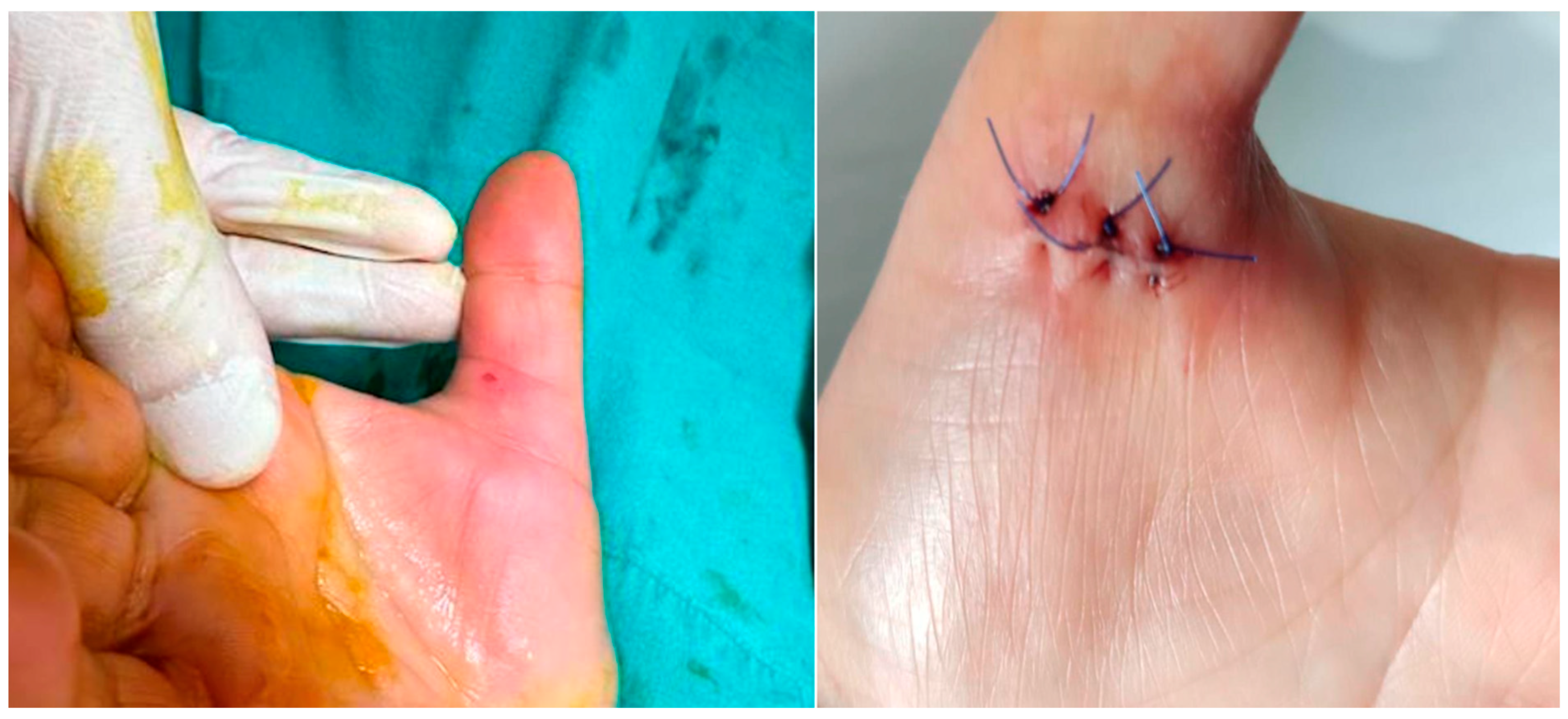 Jcm 14 07064 g003 Jcm 14 07064 g003