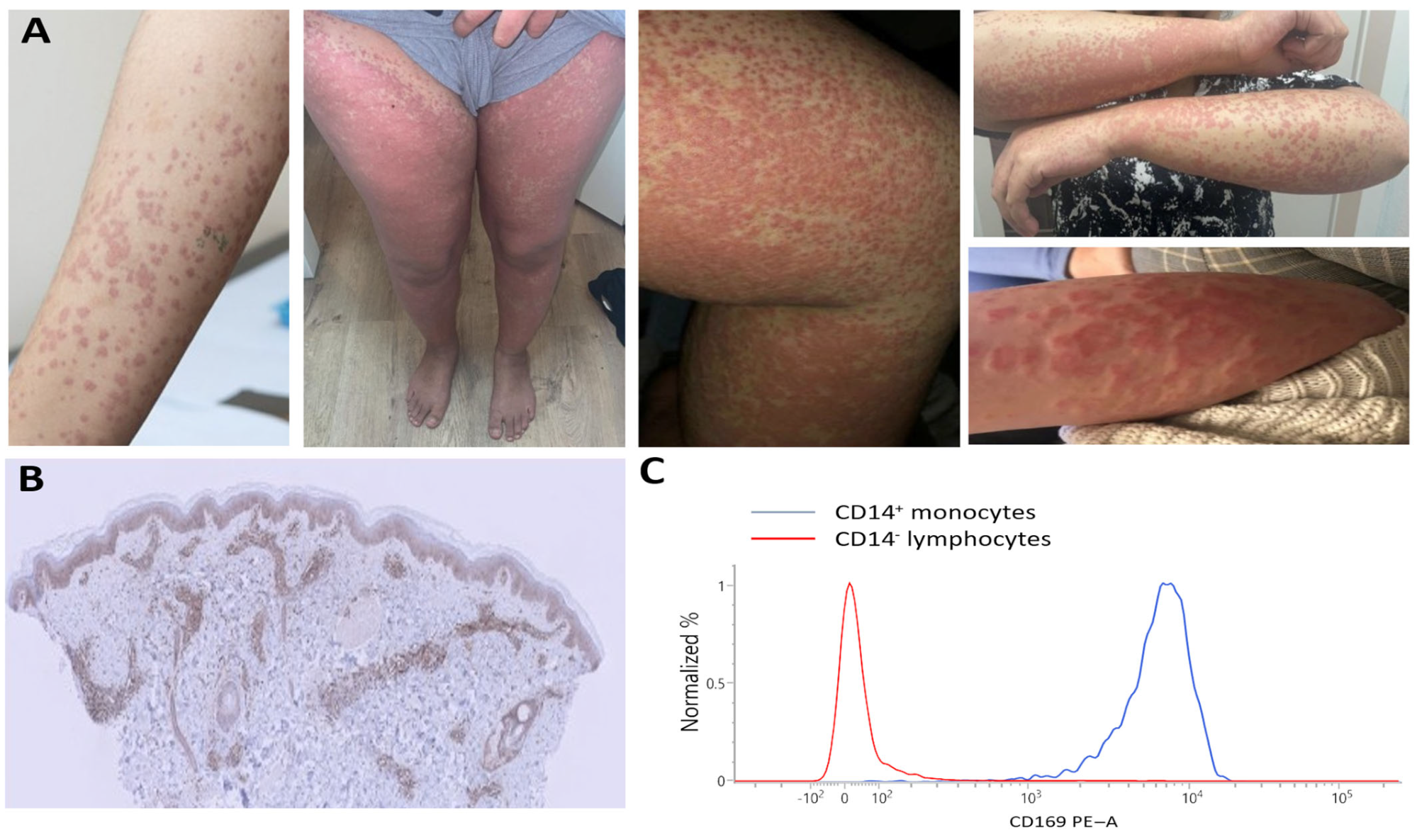 Jcm 14 07070 g002 Jcm 14 07070 g002