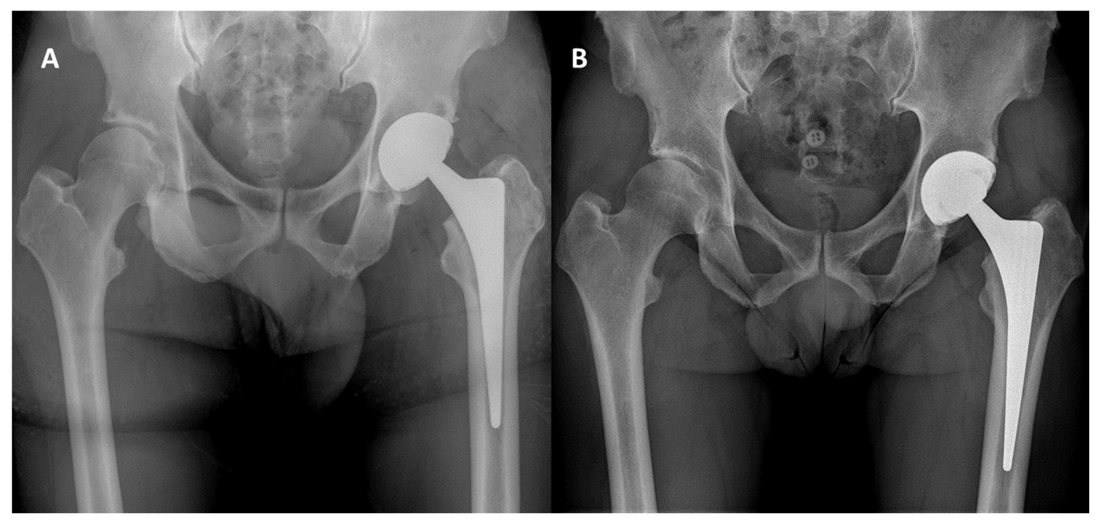 Jcm 14 07071 g004 Jcm 14 07071 g004