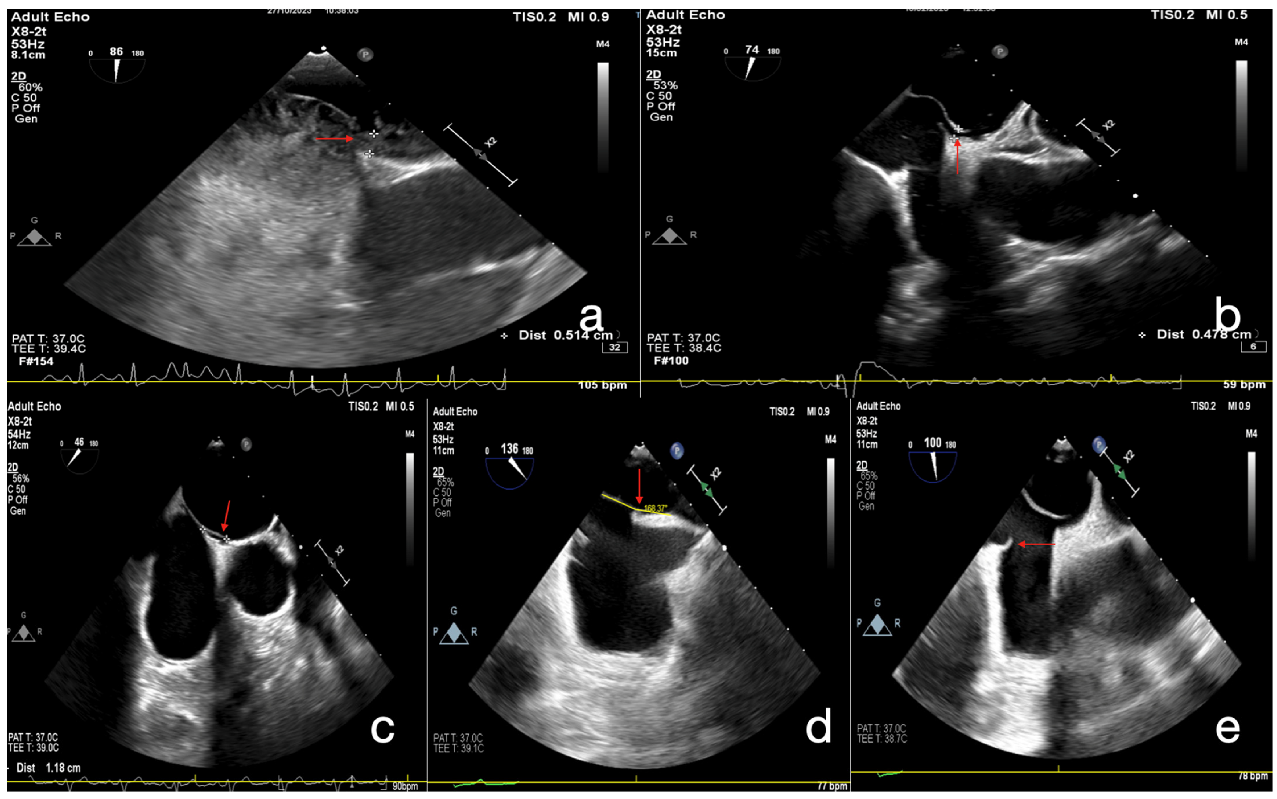 Jcm 14 07138 g002 Jcm 14 07138 g002