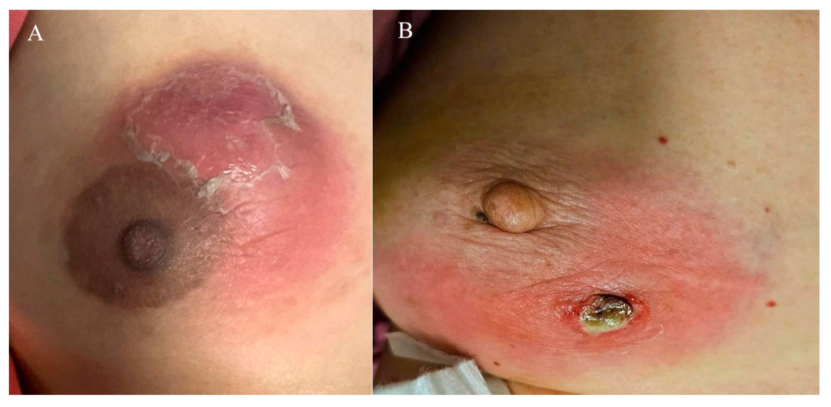 Jcm 14 07157 g002 Jcm 14 07157 g002