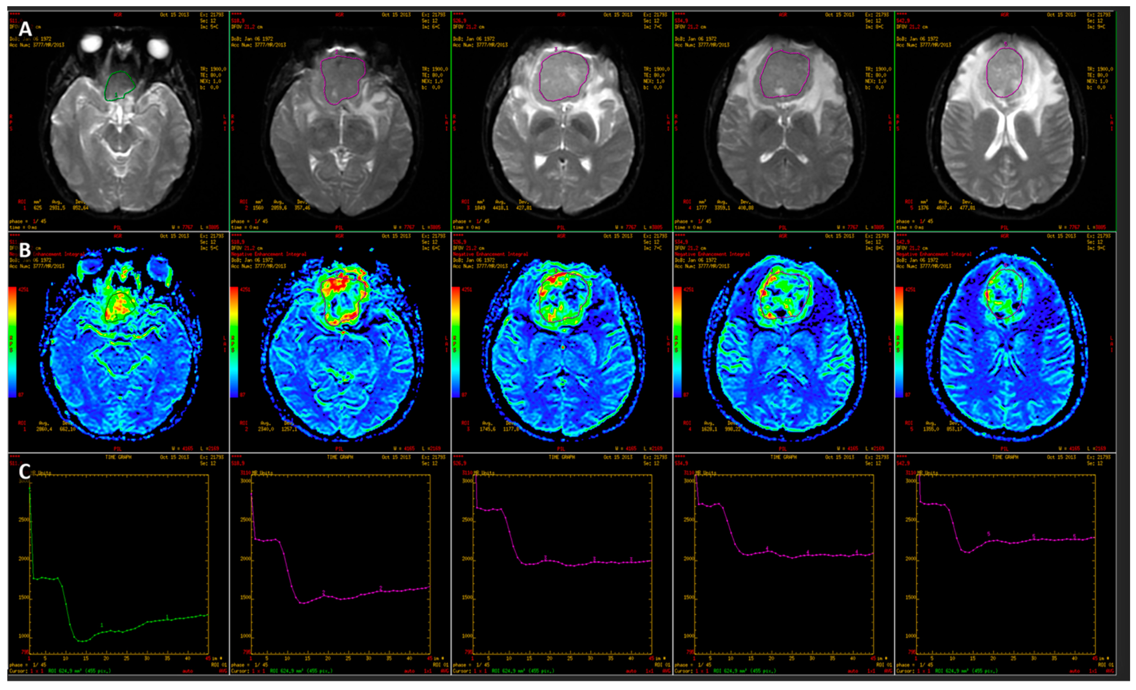 Jcm 14 07168 g002 Jcm 14 07168 g002