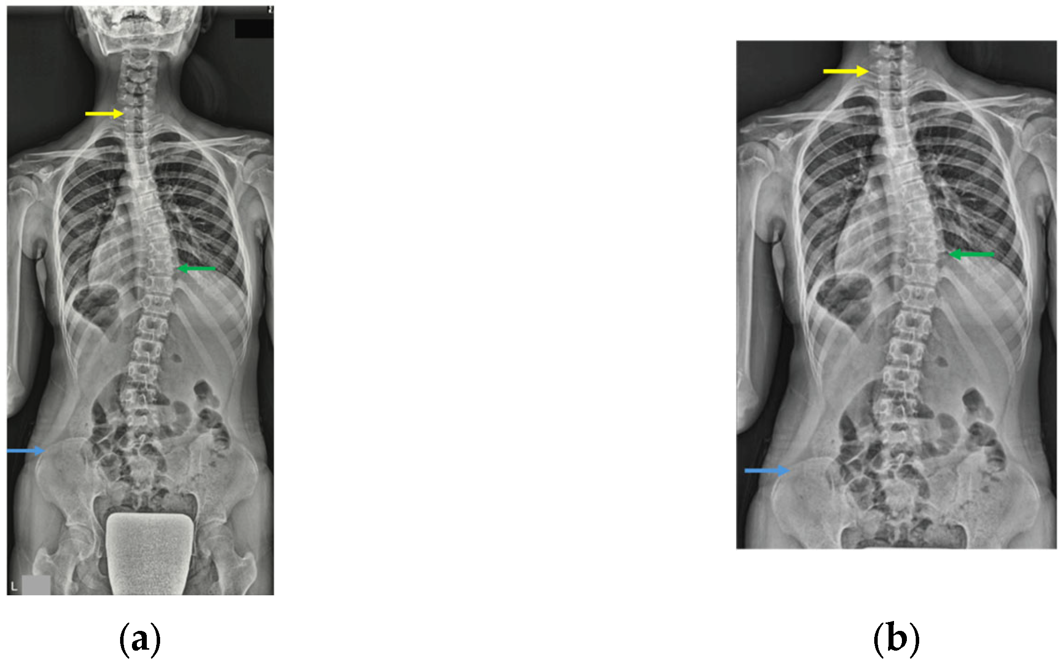 Jcm 14 07216 g001 Jcm 14 07216 g001