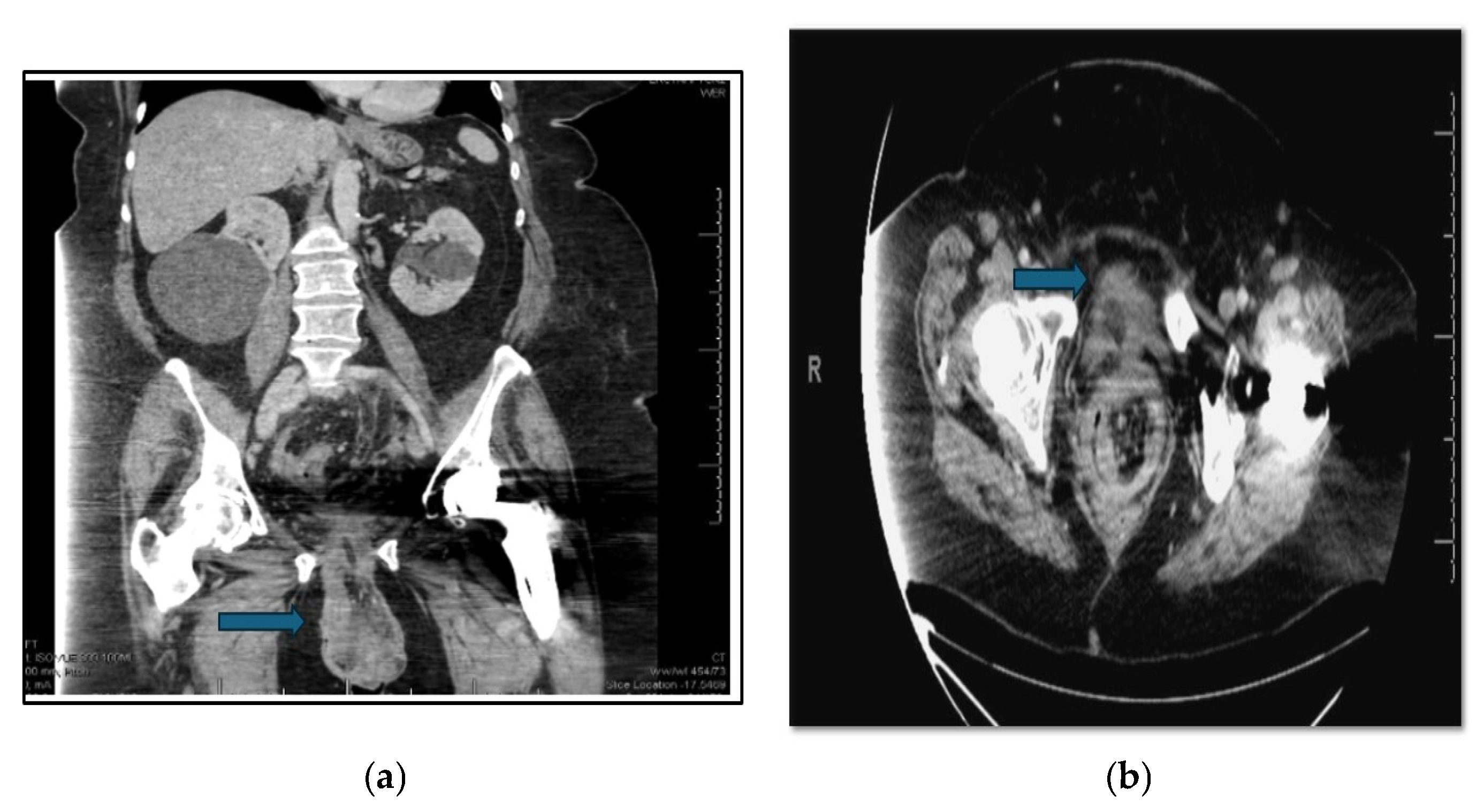 Jcm 14 07224 g002 Jcm 14 07224 g002