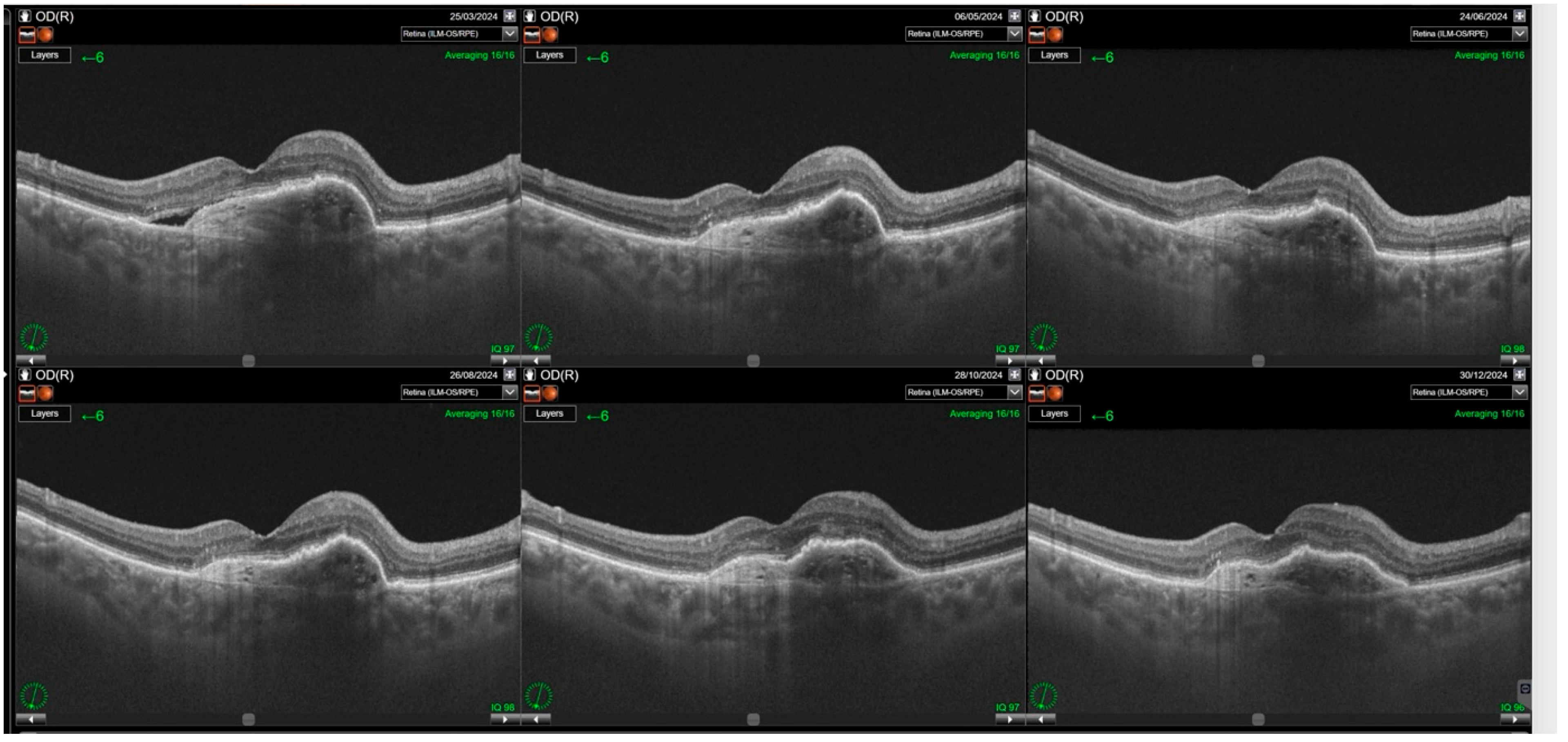 Jcm 14 07345 g002 Jcm 14 07345 g002