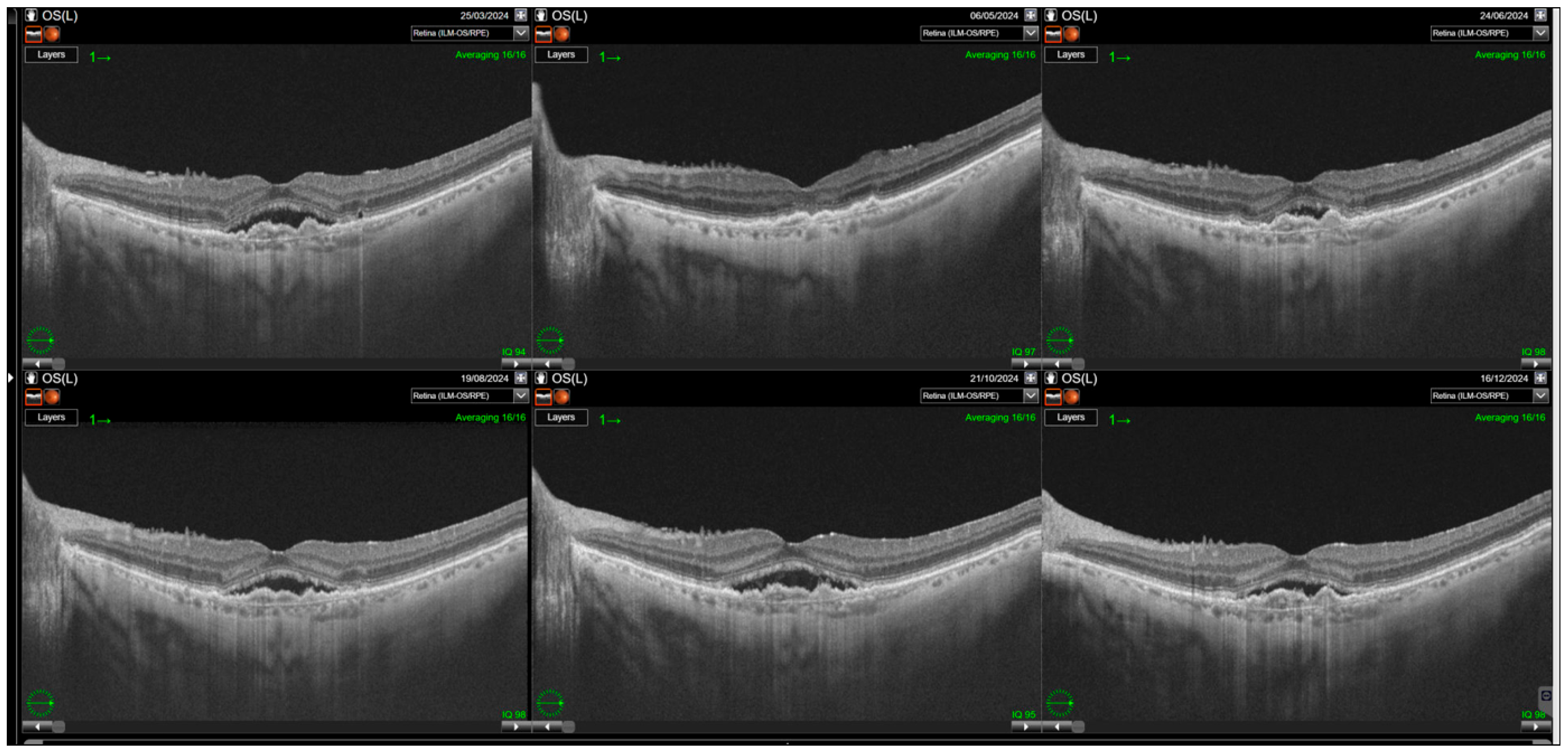 Jcm 14 07345 g004 Jcm 14 07345 g004