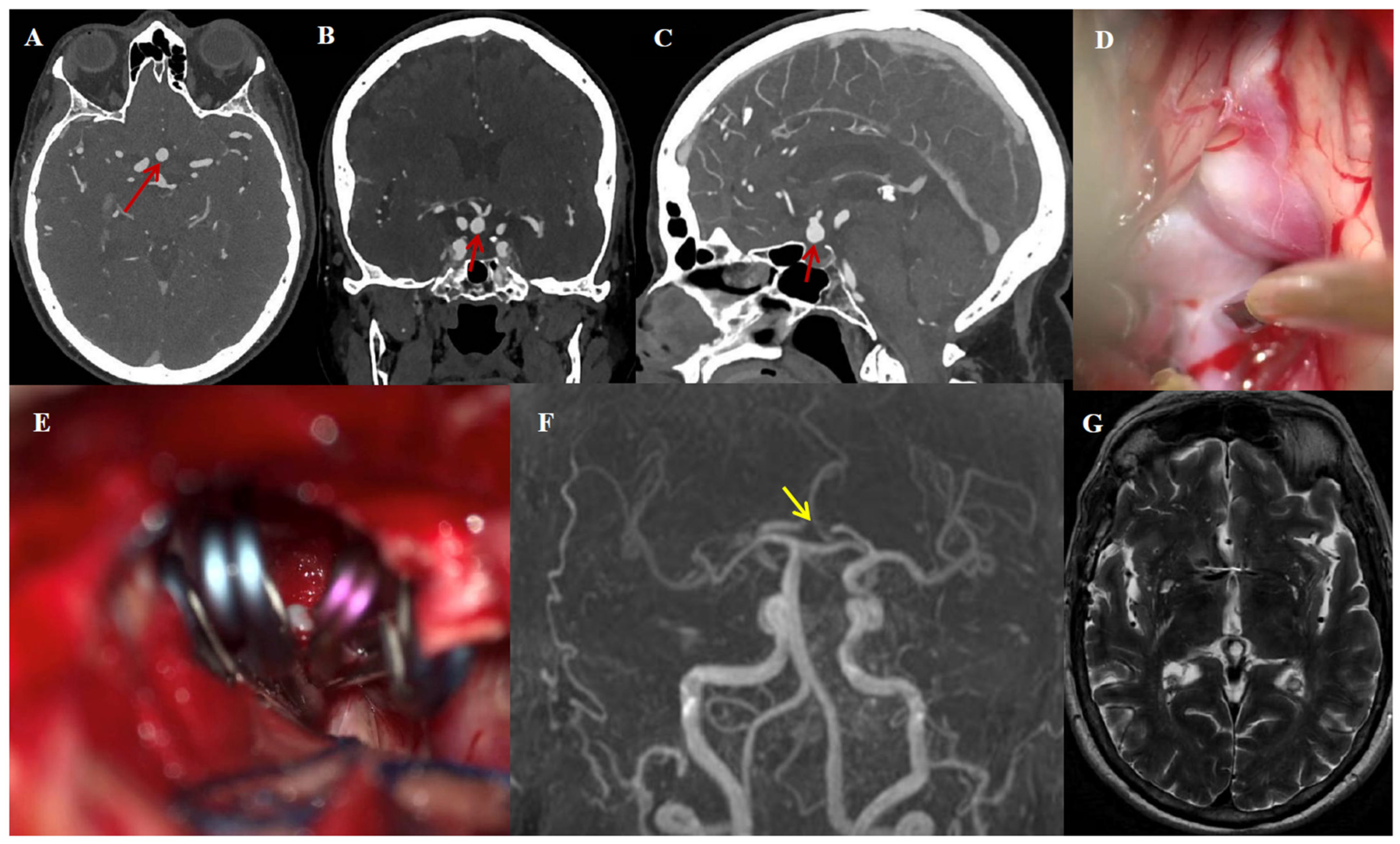 Jcm 14 07413 g003 Jcm 14 07413 g003