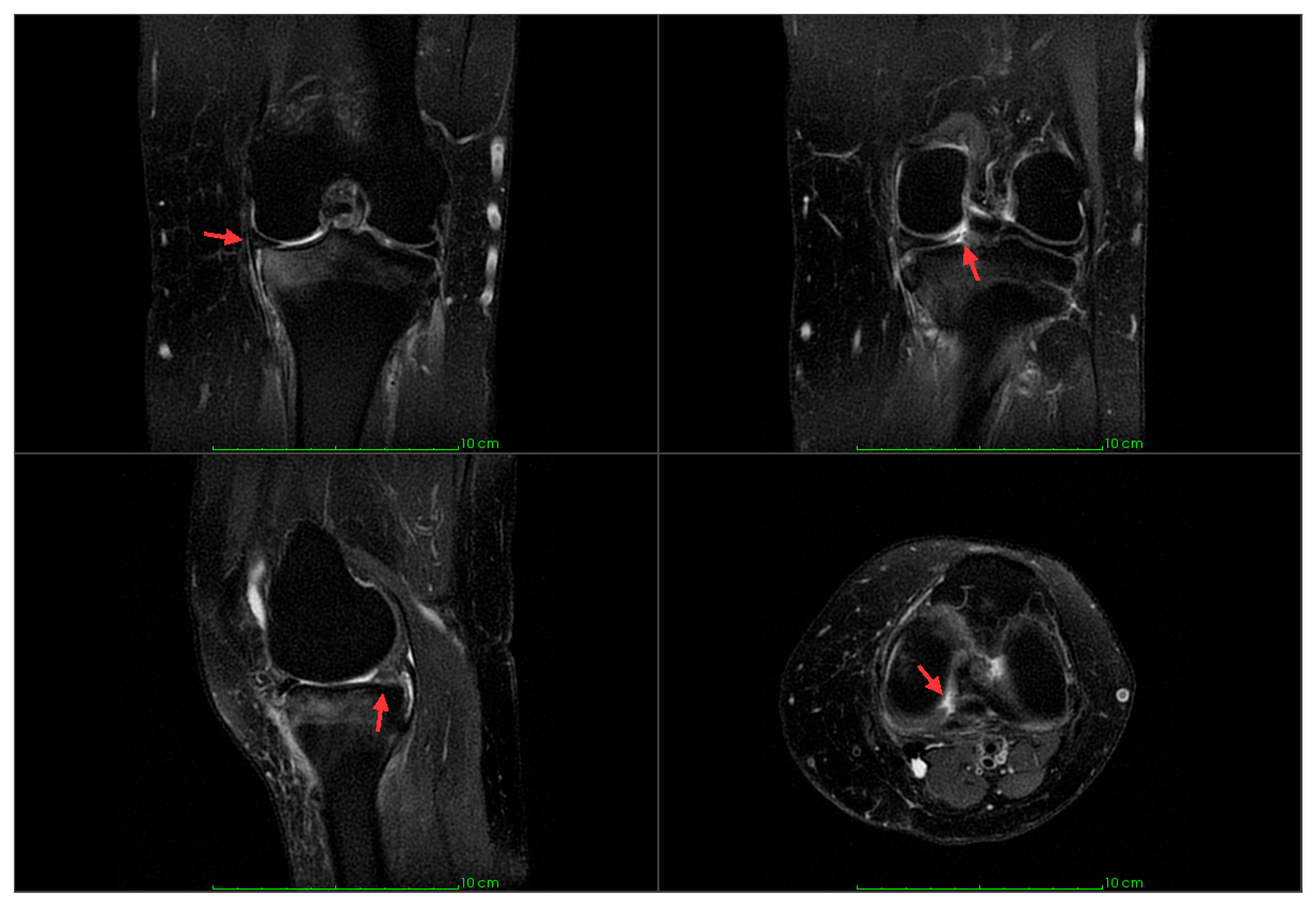 Jcm 14 07440 g001 Jcm 14 07440 g001