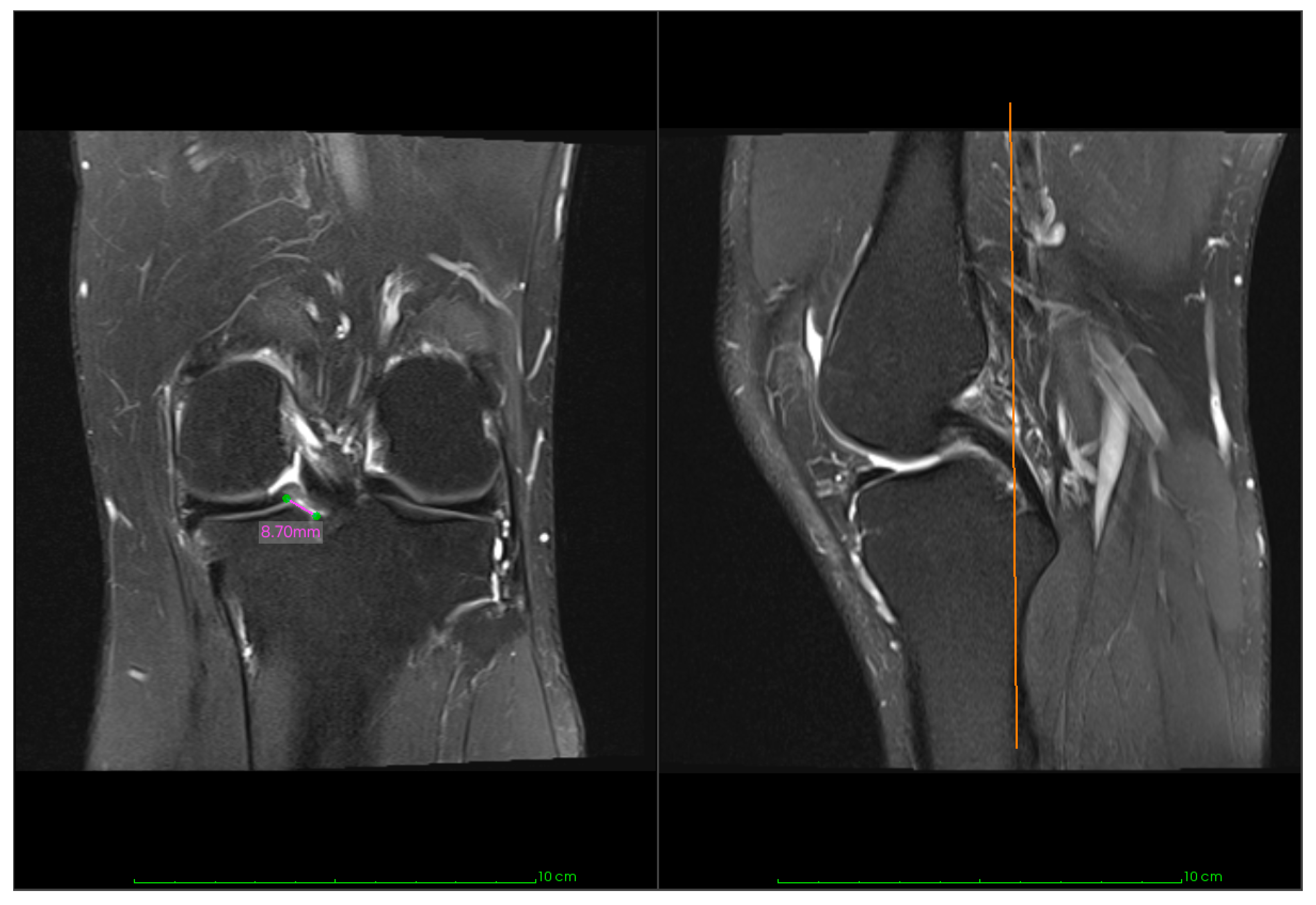 Jcm 14 07440 g002 Jcm 14 07440 g002