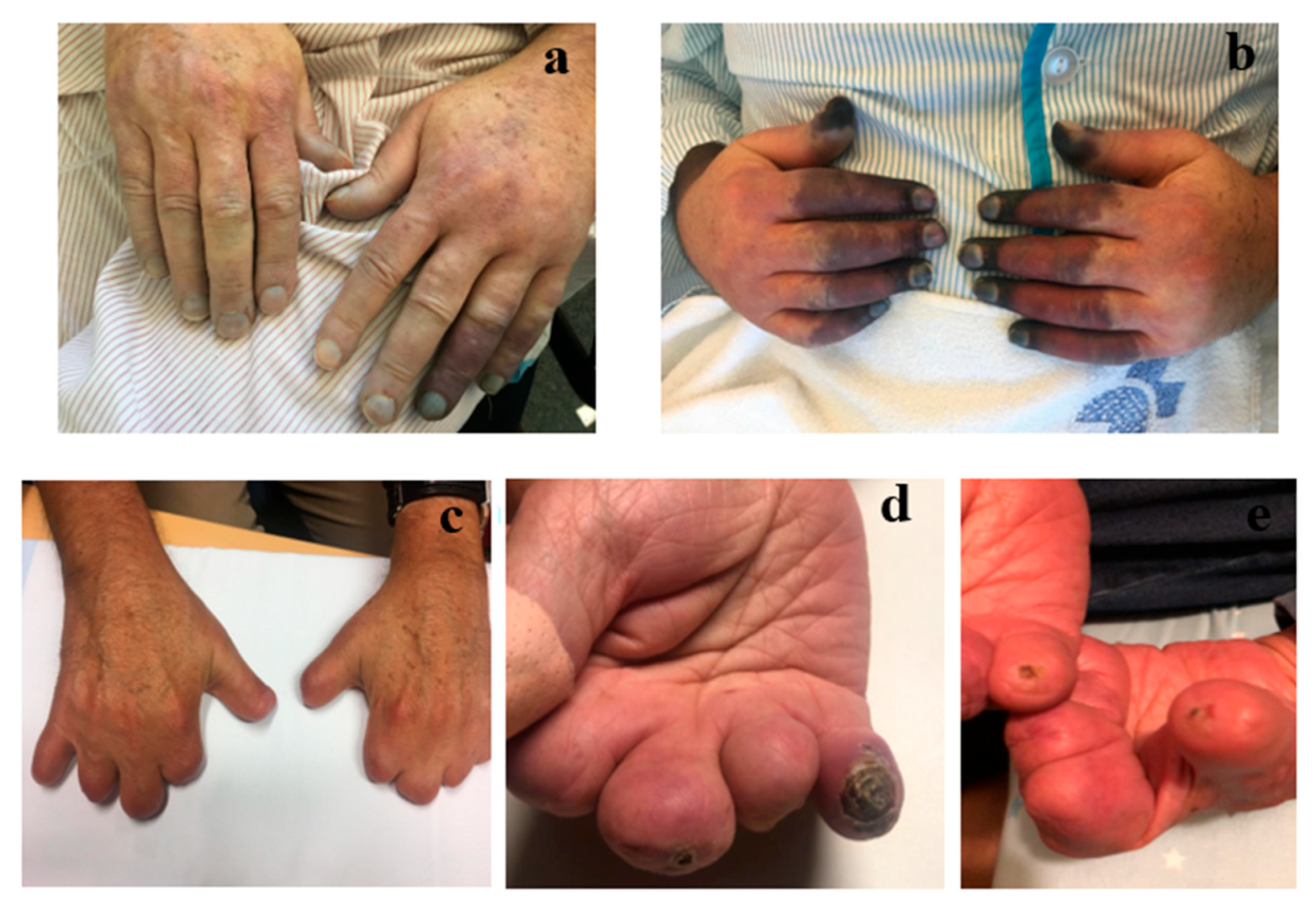 Jcm 14 07546 g002 Jcm 14 07546 g002