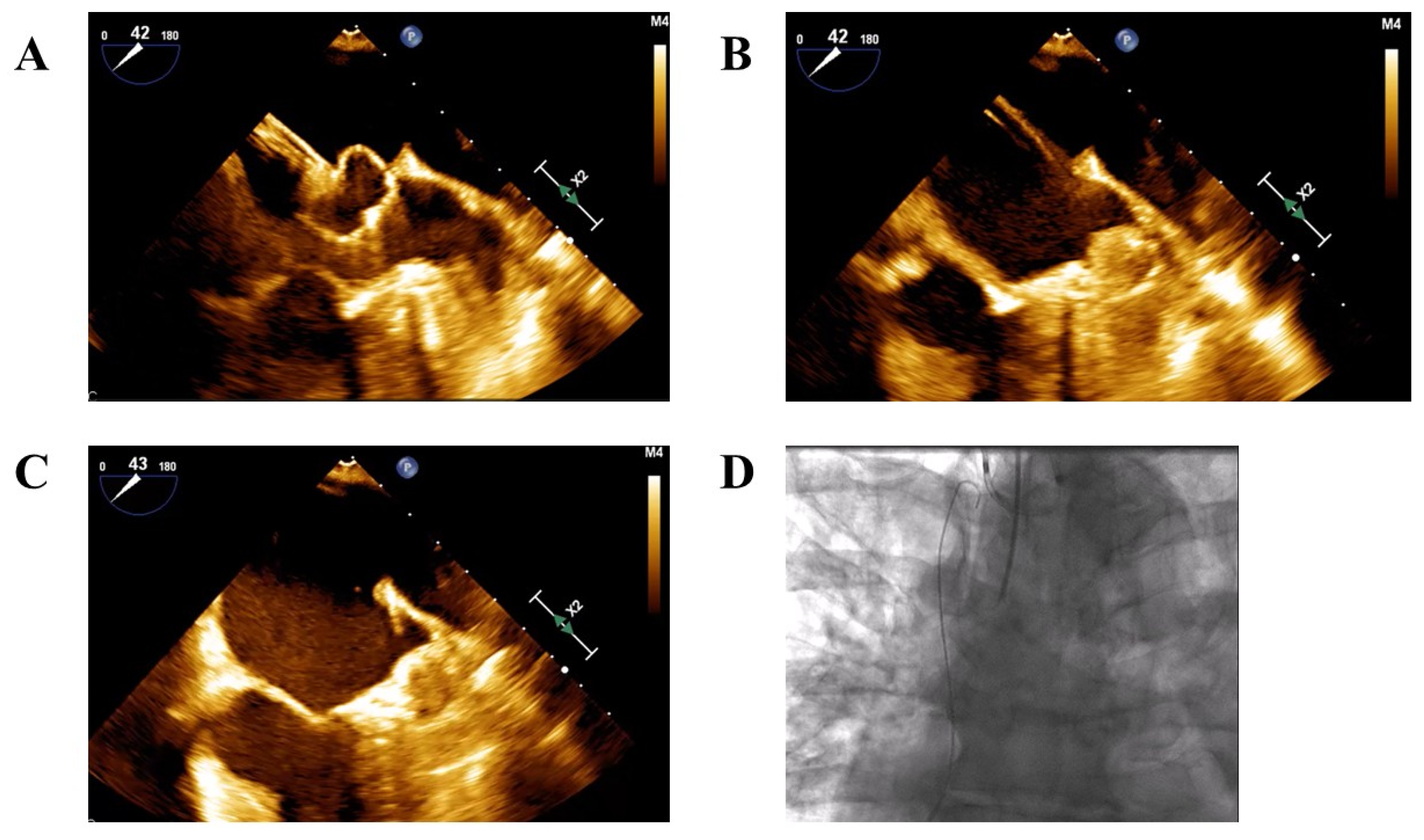 Jcm 14 07589 g001 Jcm 14 07589 g001