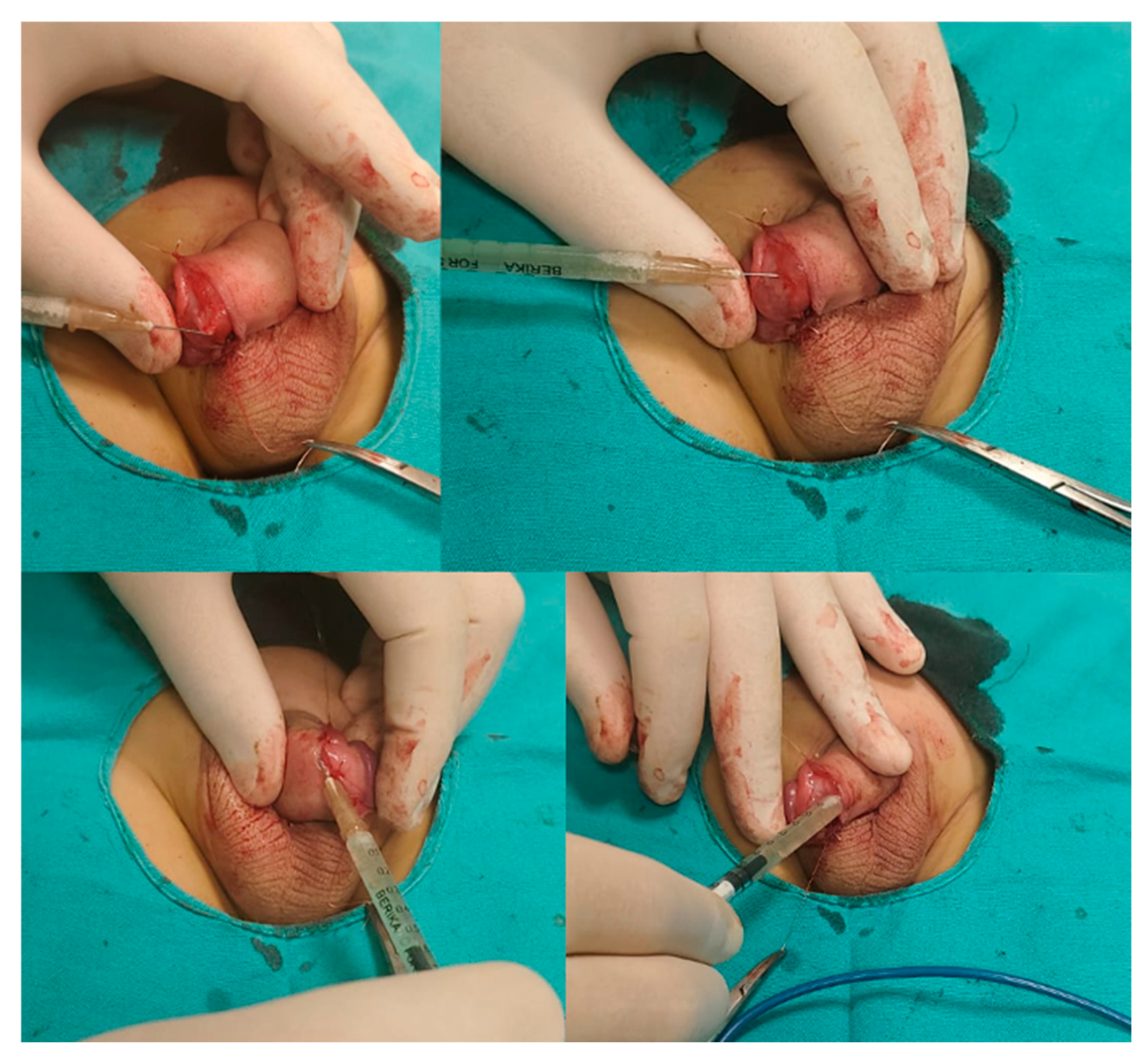 Jcm 14 07620 g003 Jcm 14 07620 g003