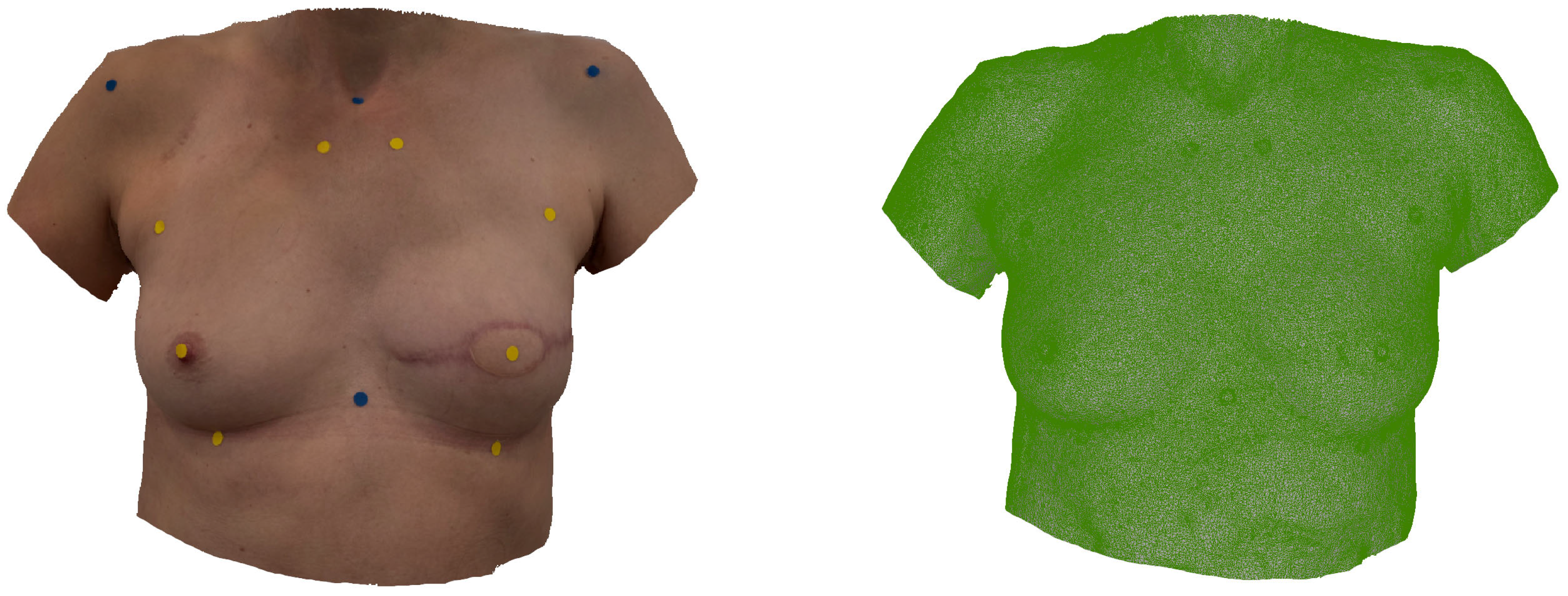 Jcm 14 07622 g003 Jcm 14 07622 g003