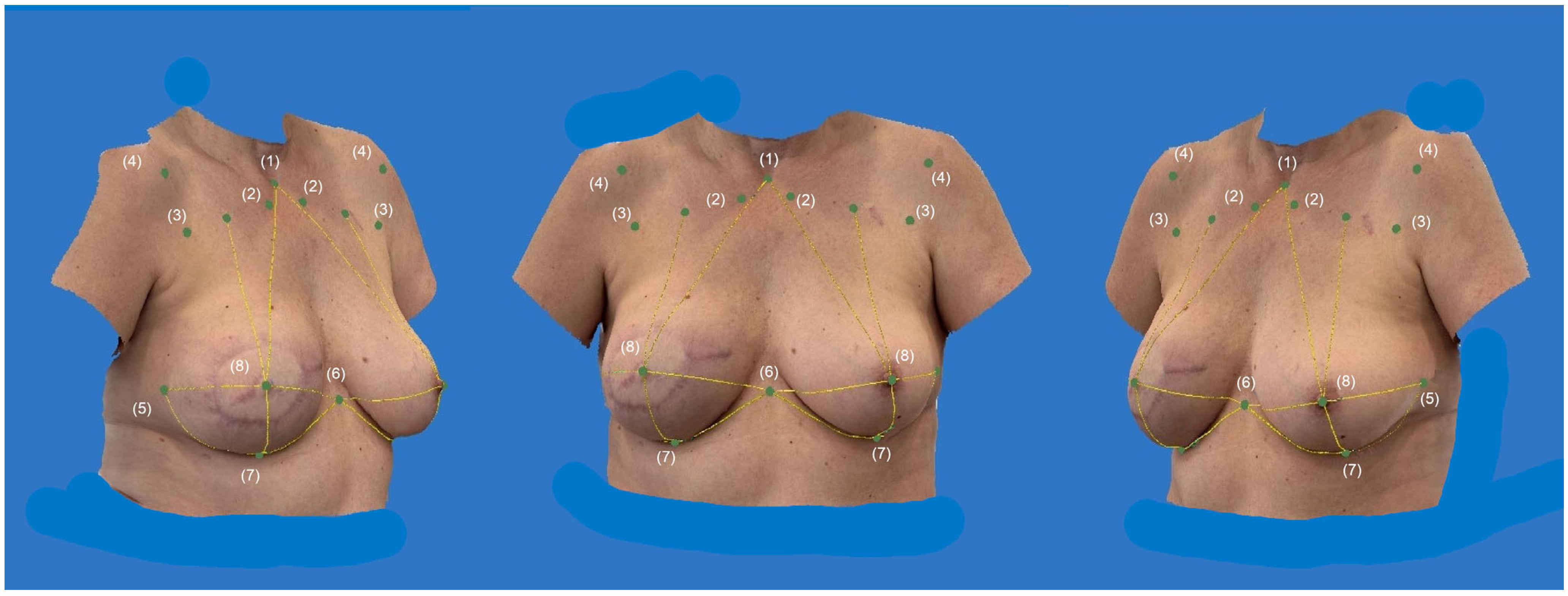 Jcm 14 07622 g004 Jcm 14 07622 g004