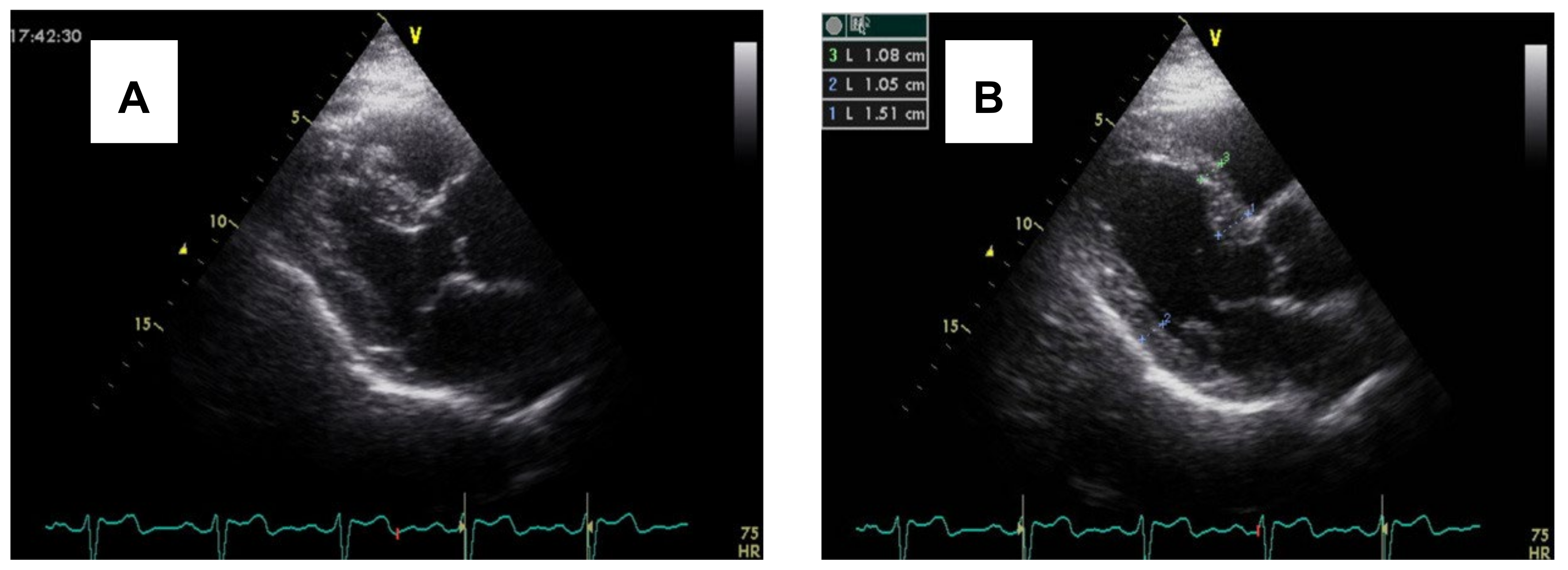 Jcm 14 07638 g001 Jcm 14 07638 g001