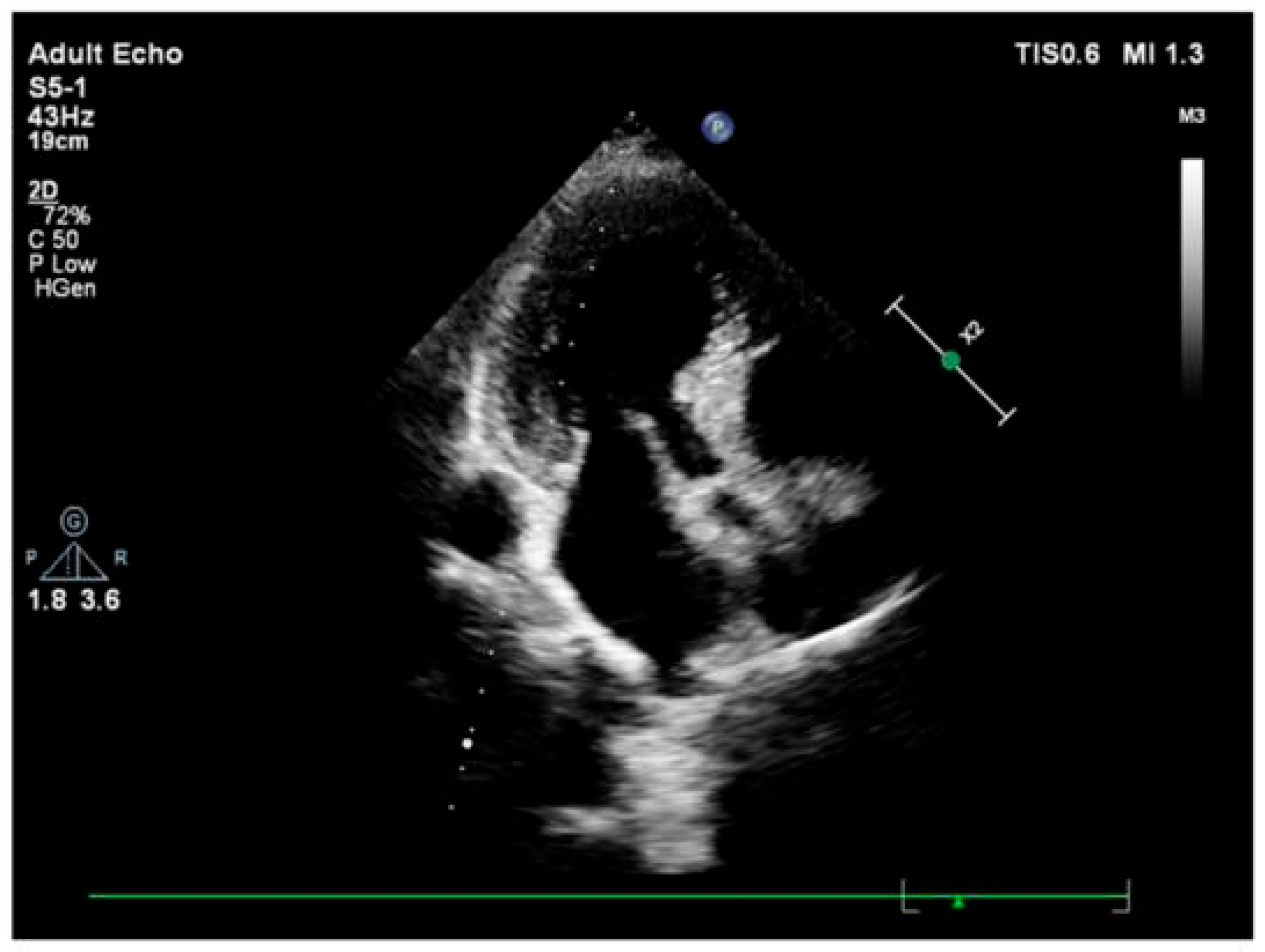 Jcm 14 07638 g003 Jcm 14 07638 g003