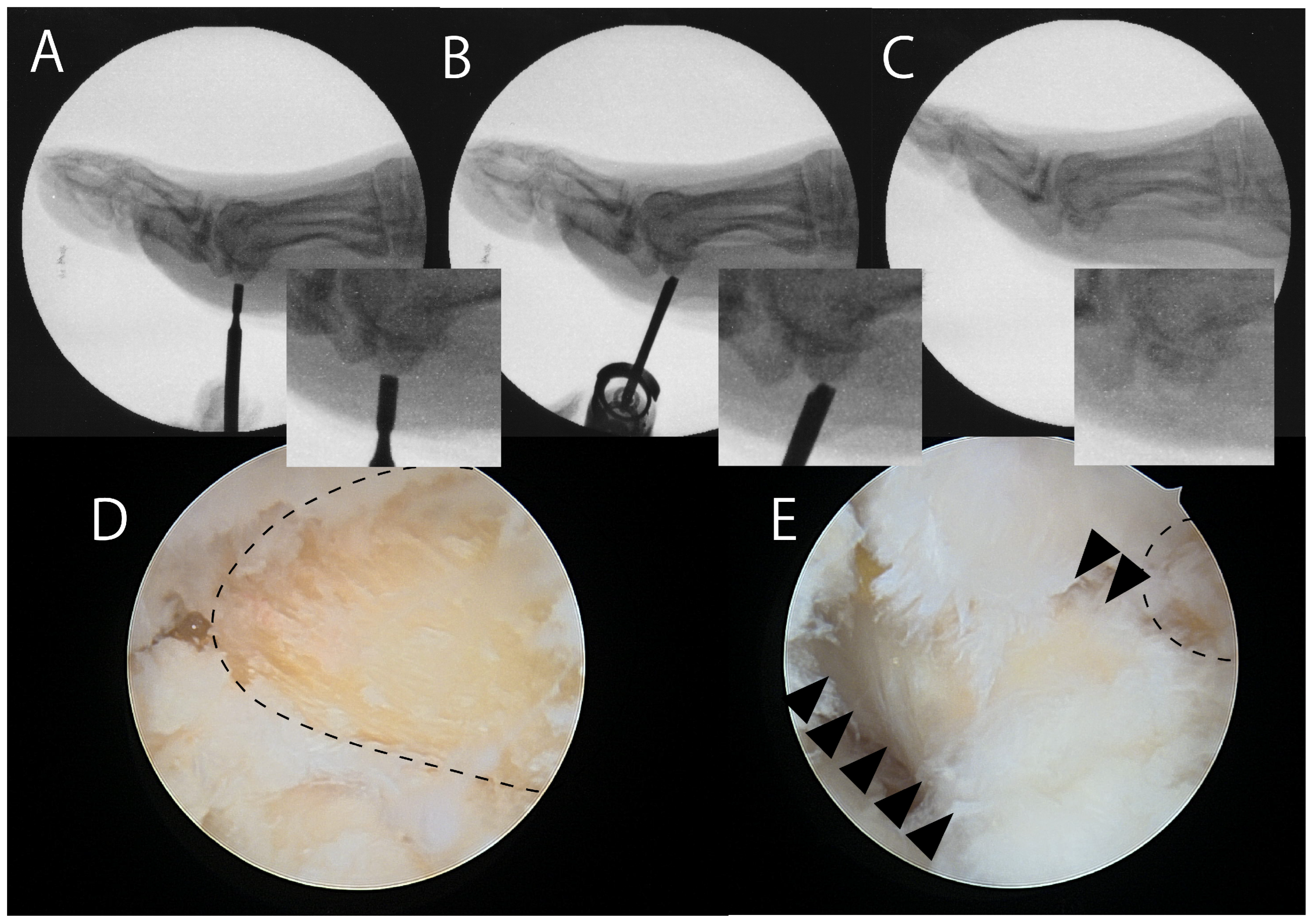 Jcm 14 07687 g004 Jcm 14 07687 g004