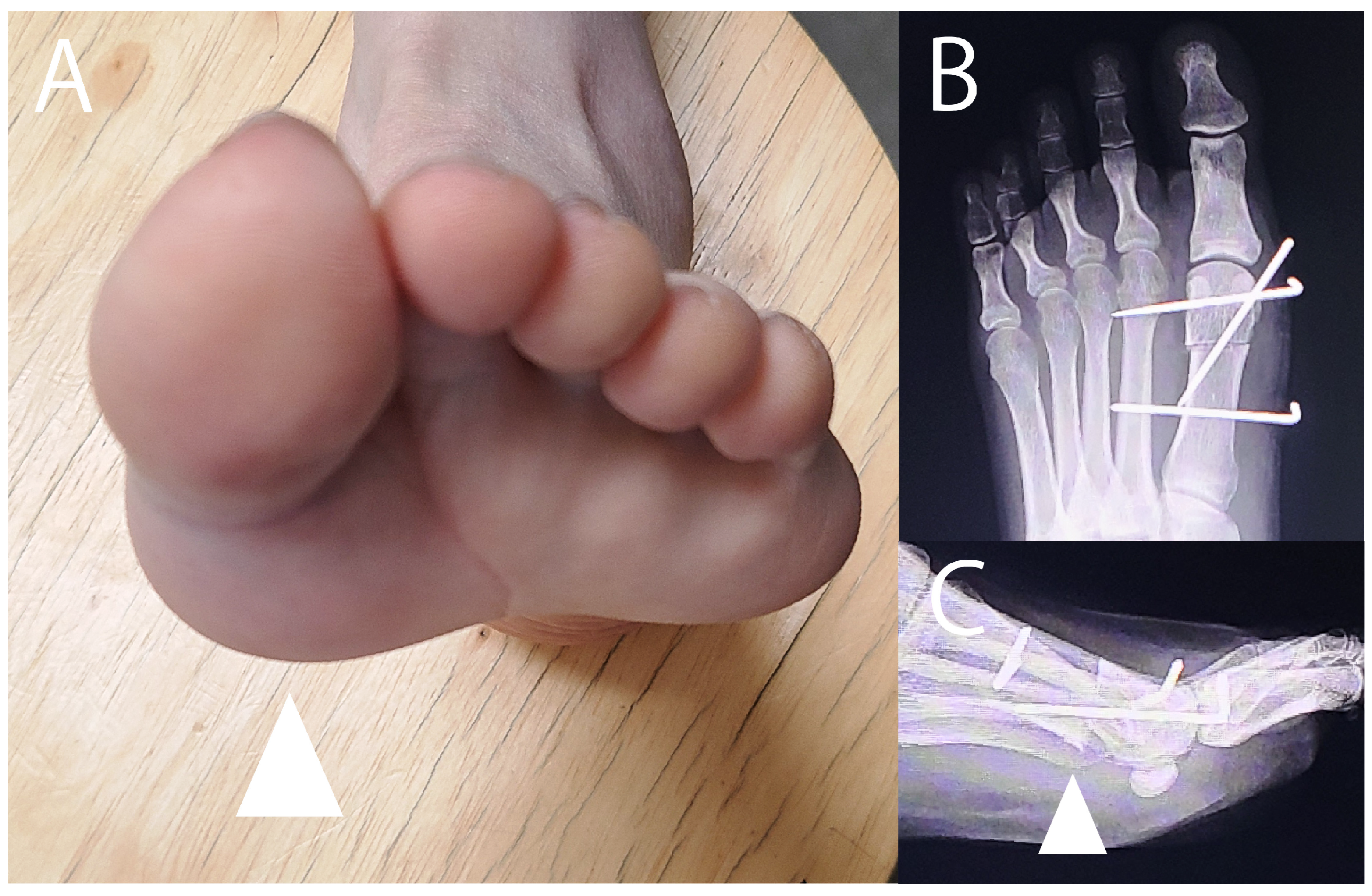 Jcm 14 07687 g005 Jcm 14 07687 g005