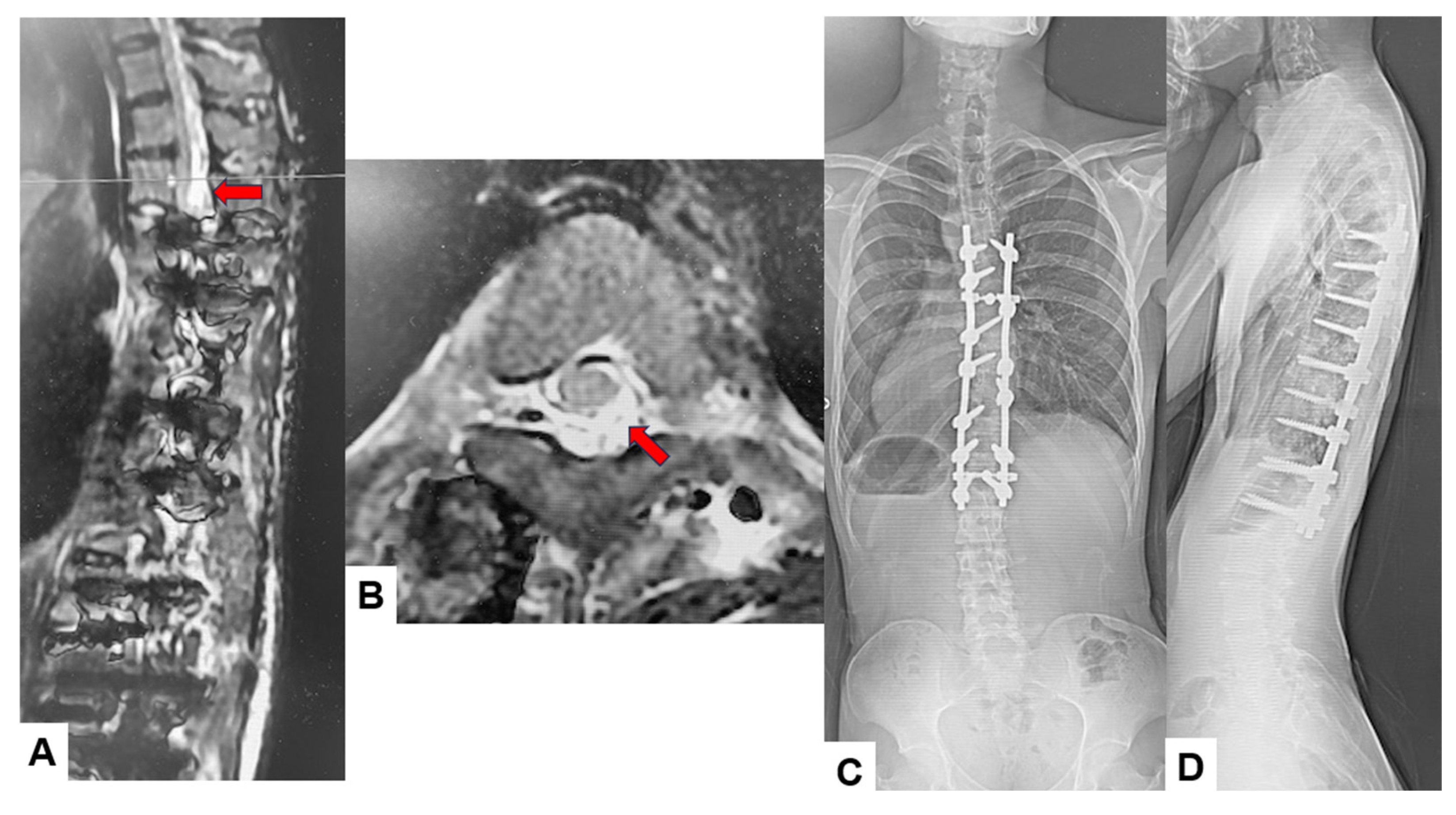 Jcm 14 07693 g004 Jcm 14 07693 g004