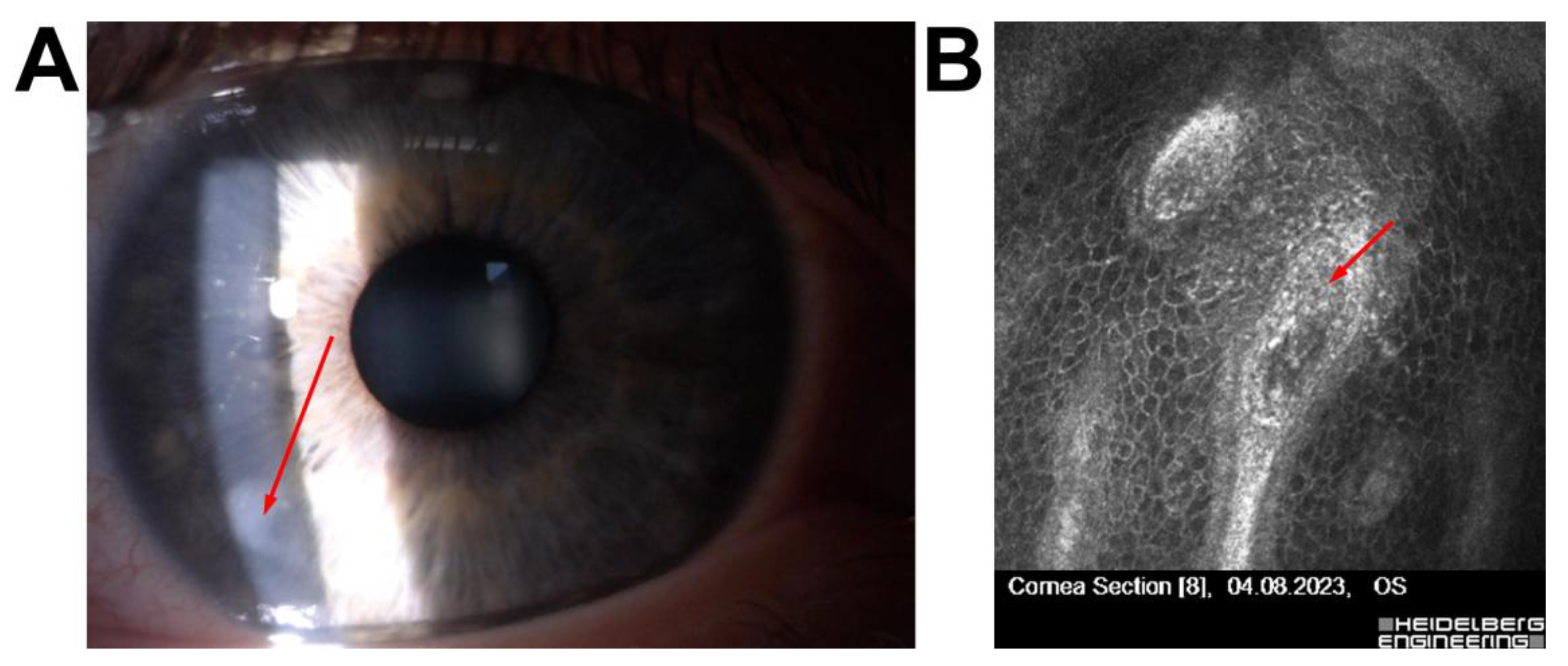 Jcm 14 07714 g003 Jcm 14 07714 g003