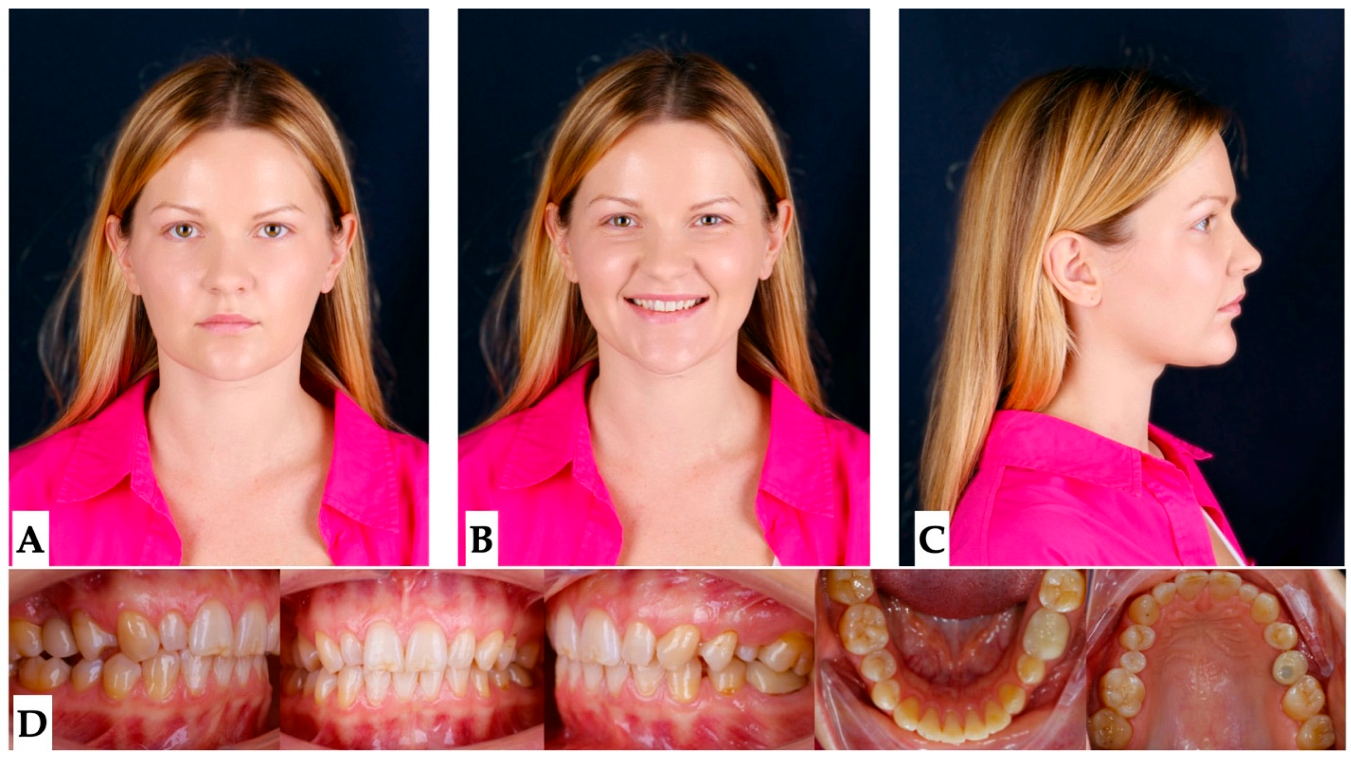 Jcm 14 07773 g001 Jcm 14 07773 g001